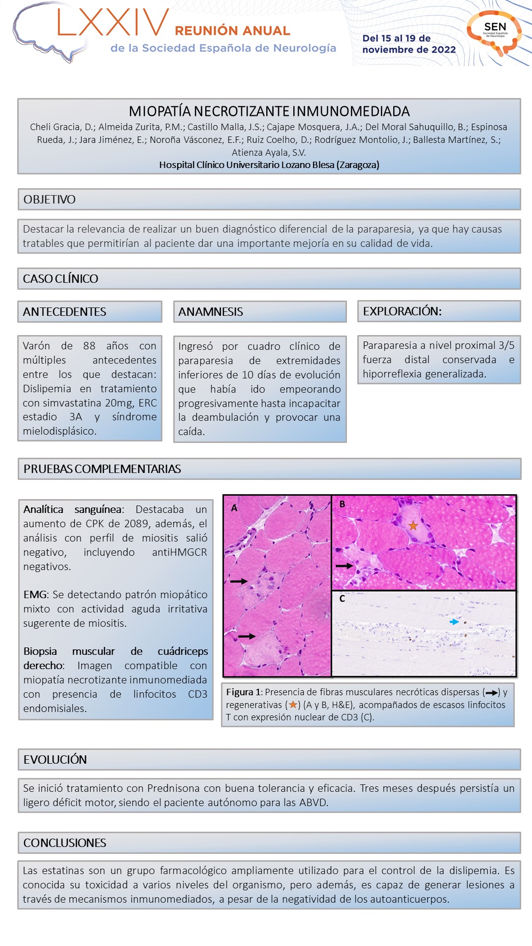 Miopatía necrotizante inmunomediada