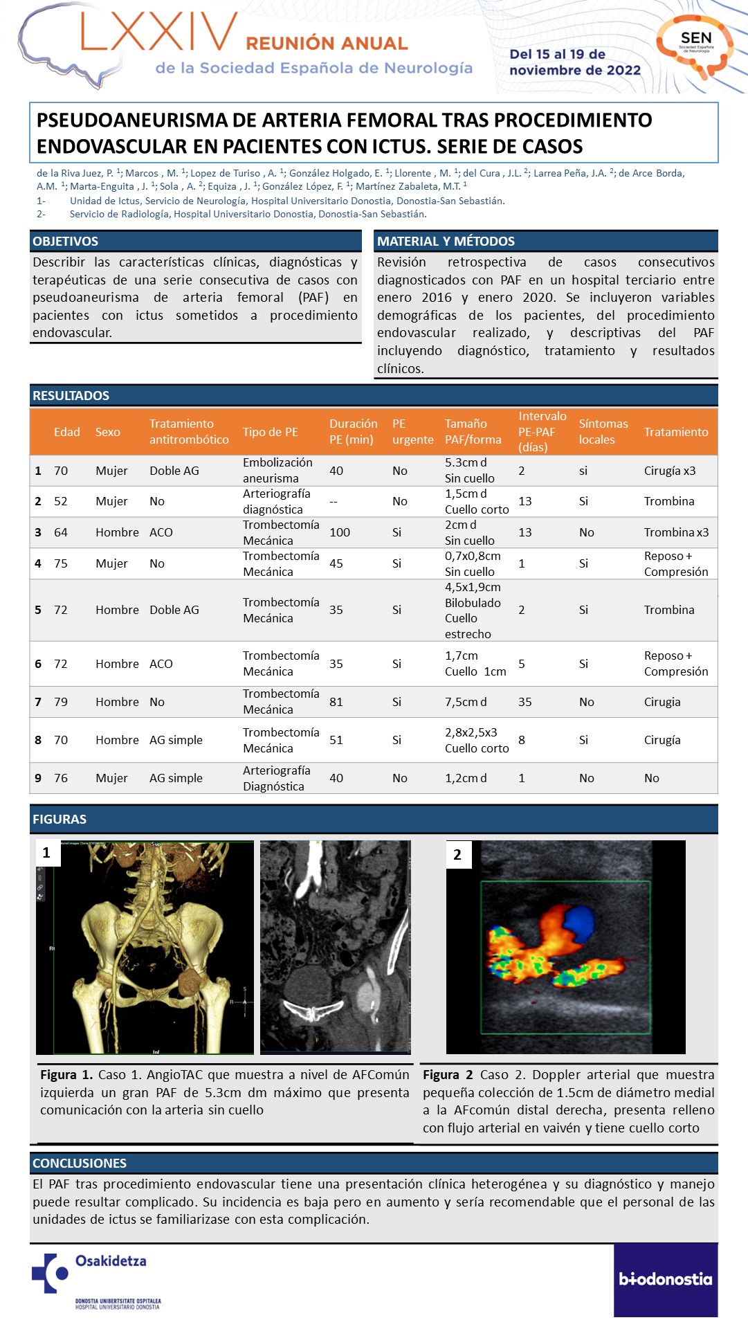 Pseudoaneurisma de arteria femoral tras procedimiento endovascular en pacientes con ictus. Serie de casos