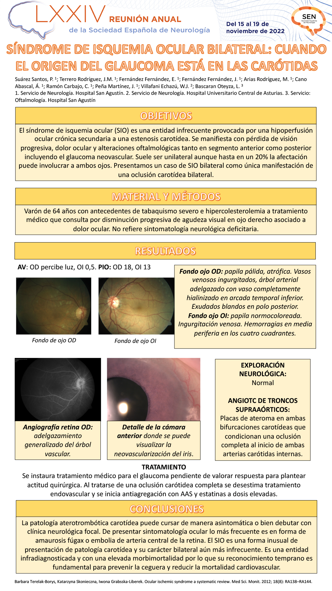 Síndrome de isquemia ocular bilateral: cuando el origen del glaucoma está en las carótidas