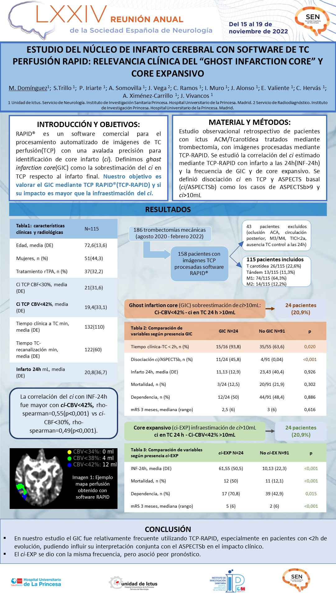 Estudio del núcleo de infarto cerebral con software de TC perfusión RAPID: relevancia clínica del “ghost infarction core” y core expansivo