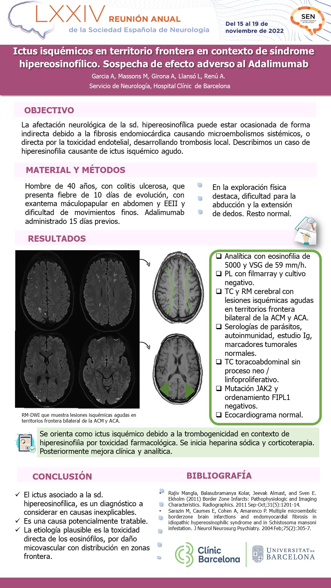 Ictus isquémicos en territorio frontera bilateral en contexto de síndrome hipereosinofílico. Sospecha de efecto adverso del Adalimumab