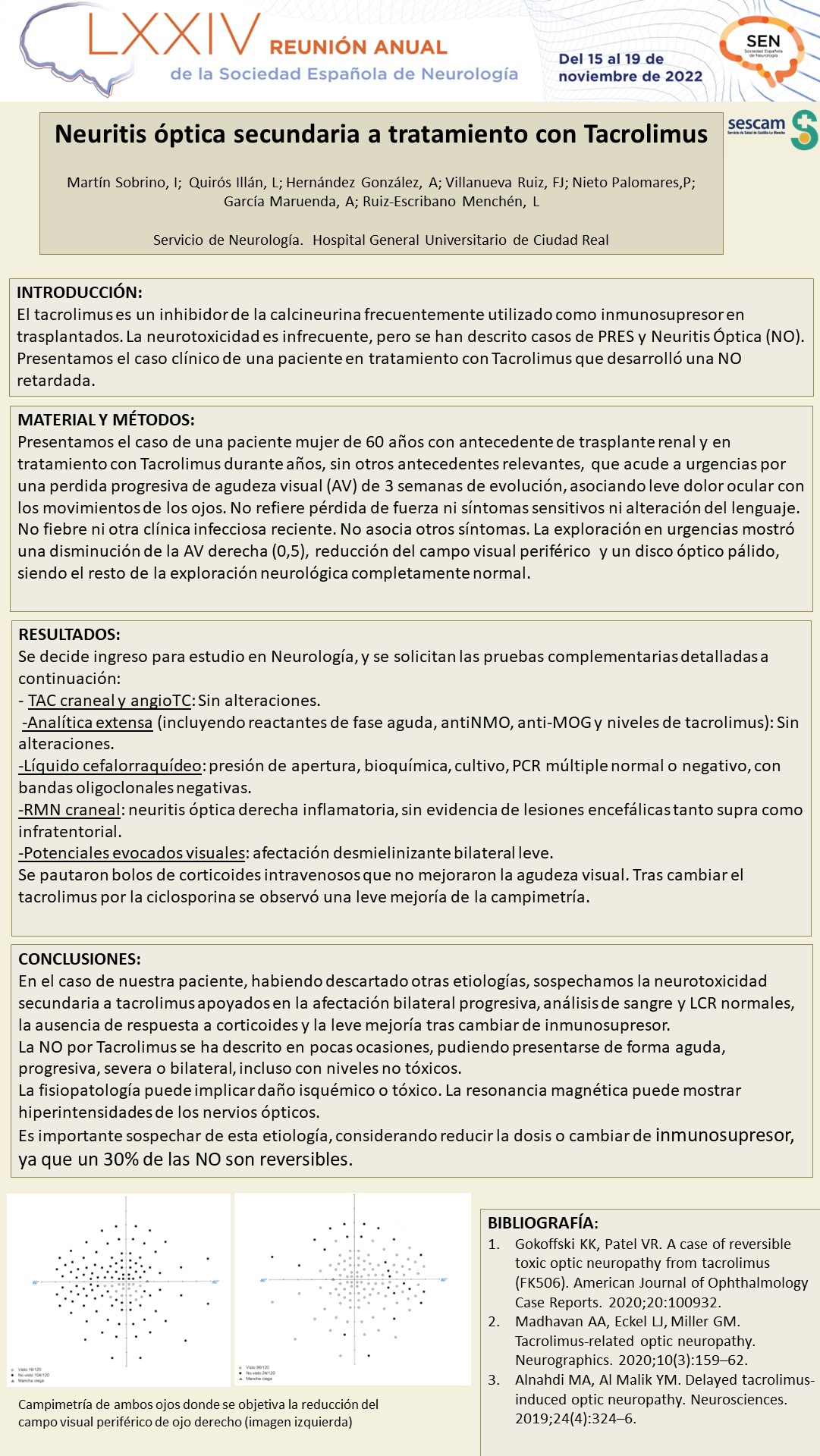 Neuropatía óptica (NO): un efecto neurotóxico retardado del tratamiento con Tacrolimus