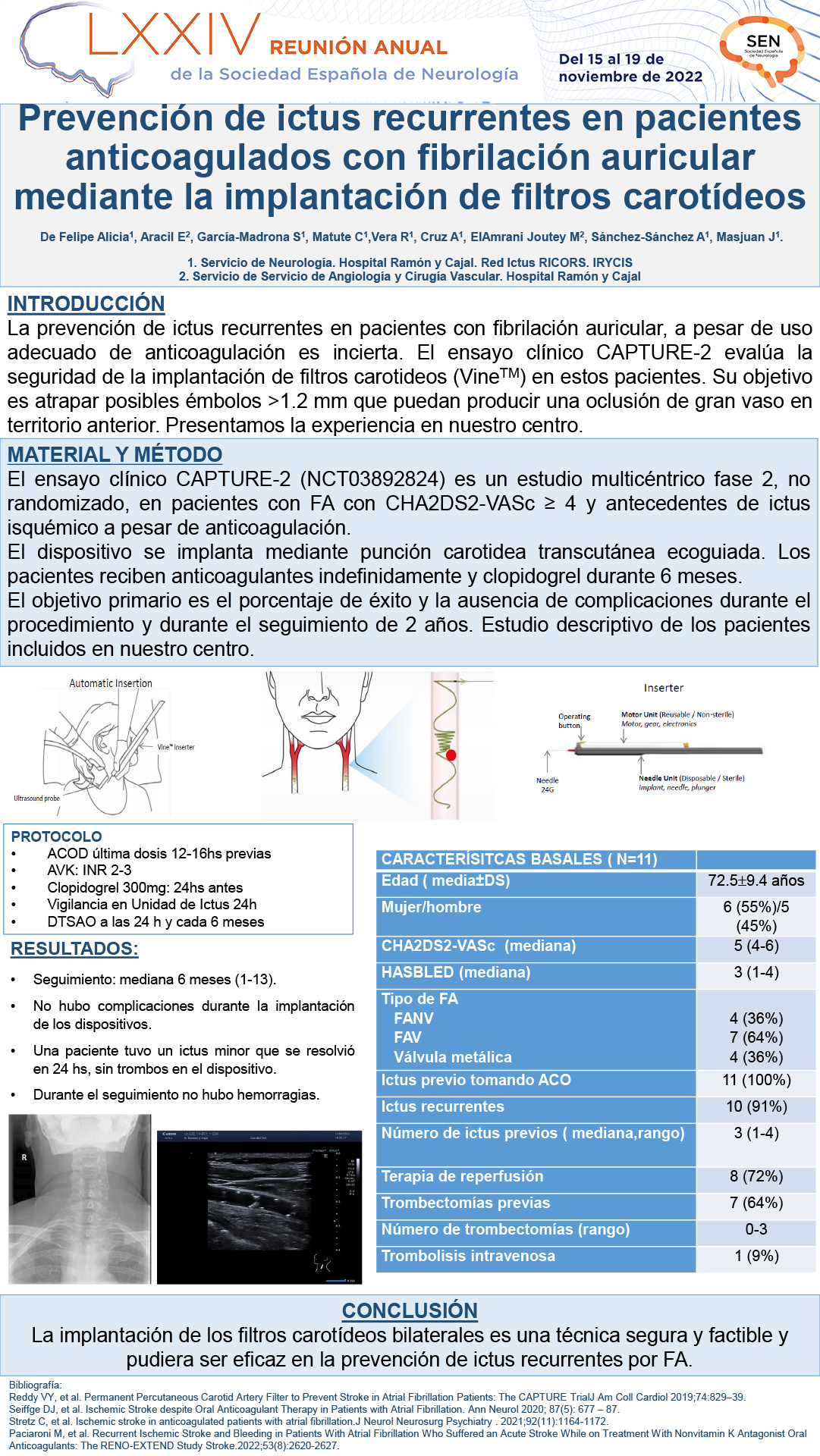 Prevención de ictus recurrentes en pacientes anticoagulados con fibrilación auricular mediante la implantación de filtros carotídeos
