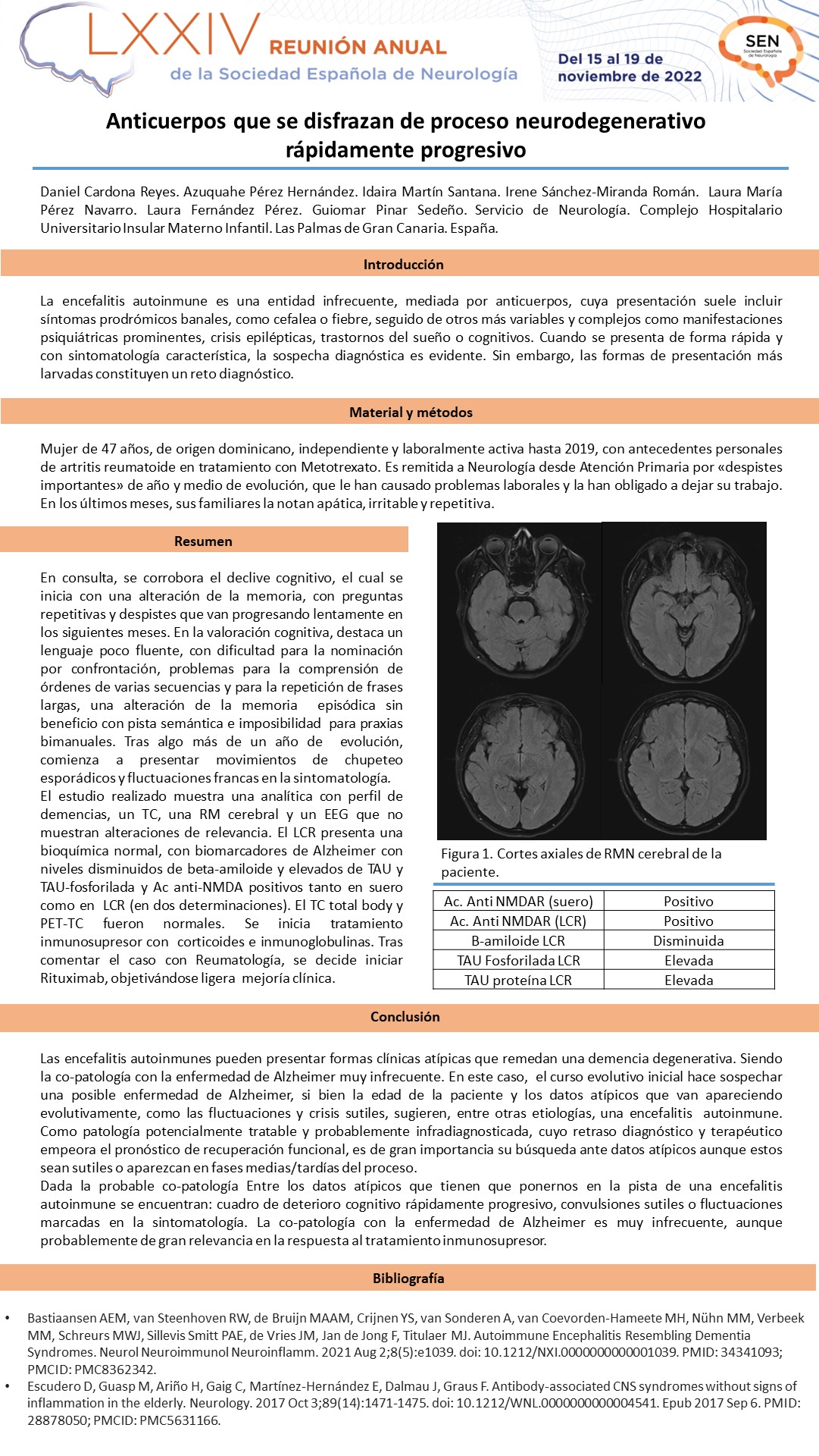 Anticuerpos que se disfrazan de proceso neurodegenerativo rápidamente progresivo