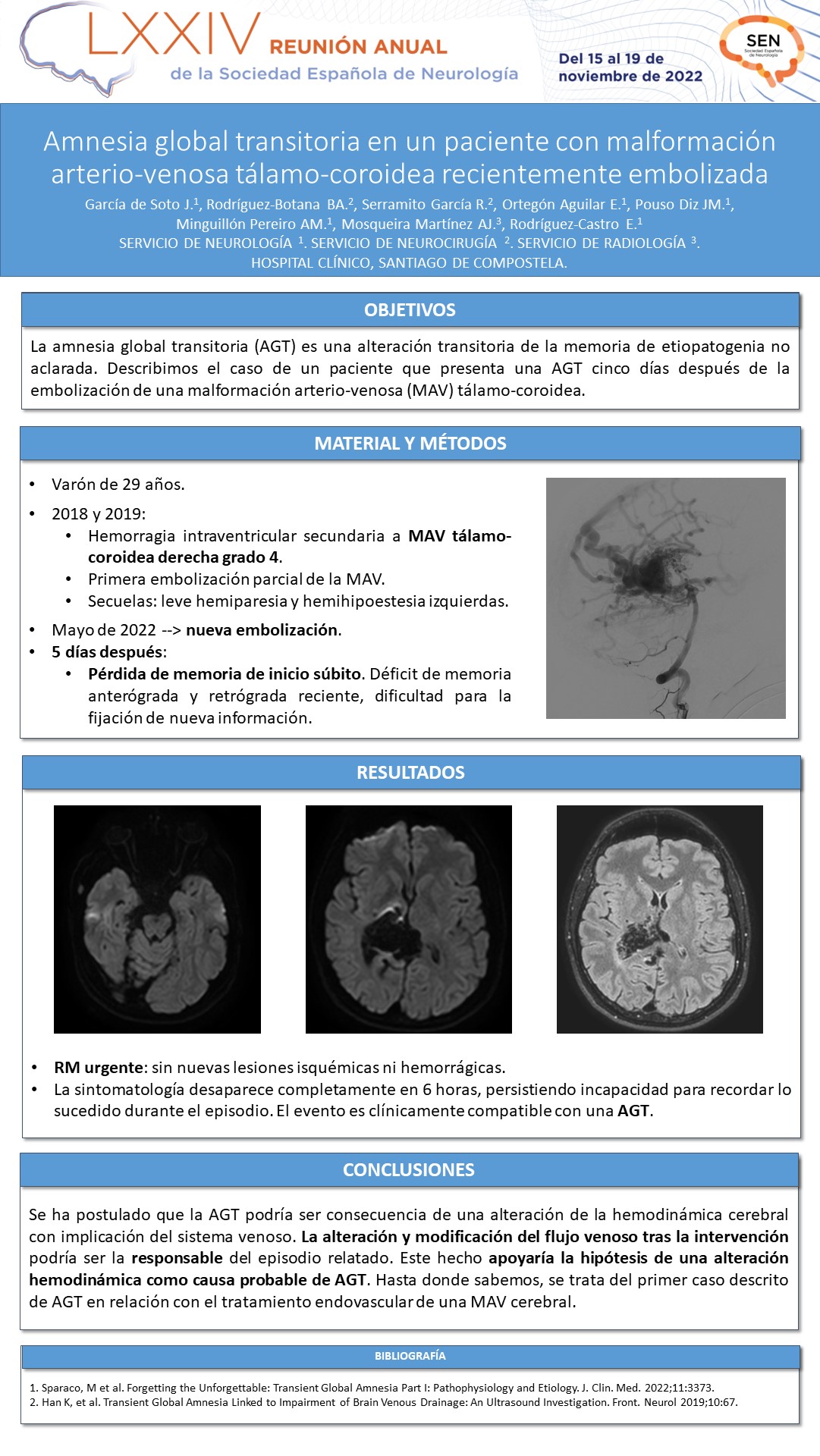 Amnesia global transitoria en un paciente con malformación arterio-venosa tálamo-coroidea recientemente embolizada
