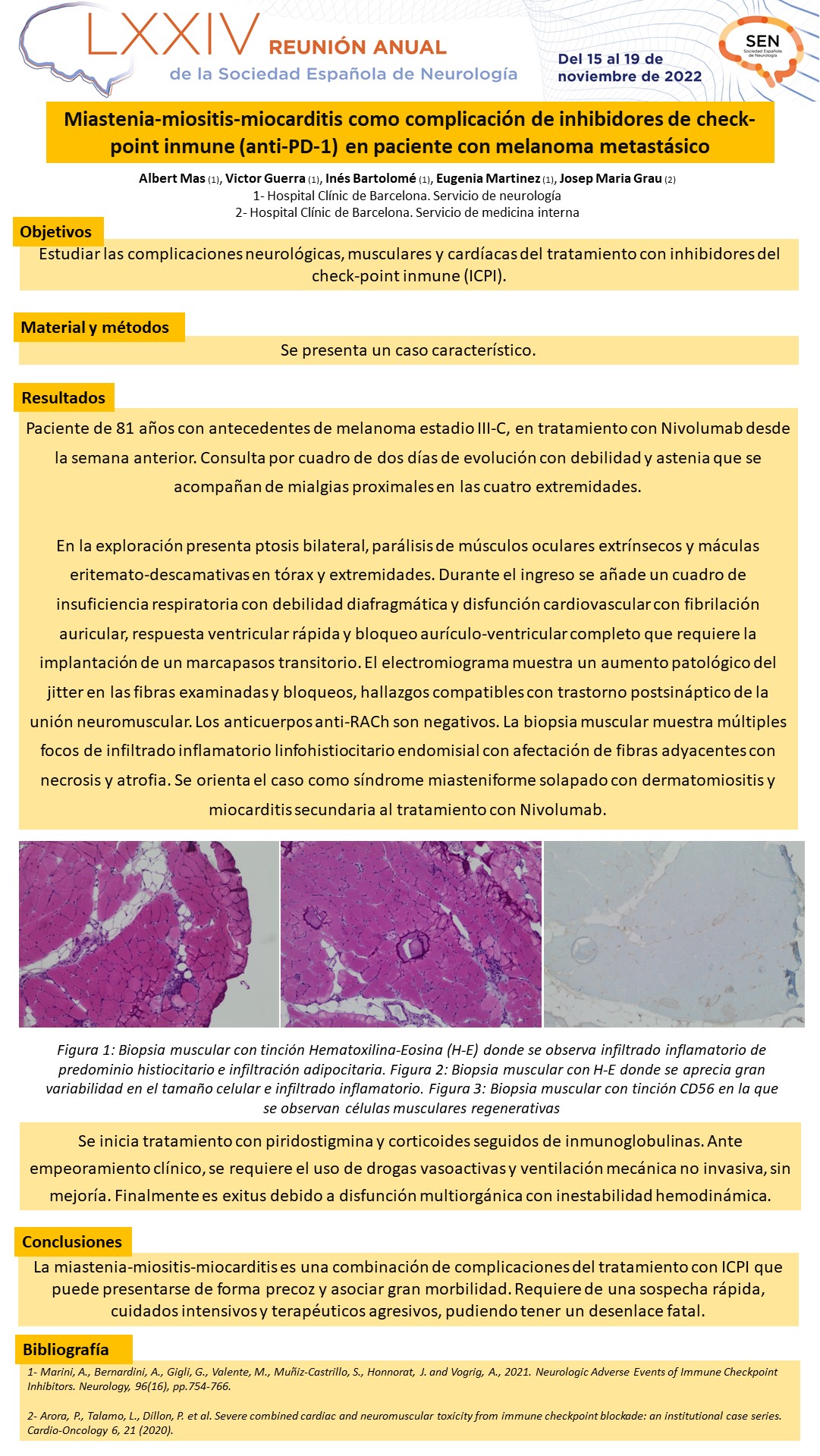 Miastenia-miositis-miocarditis como complicación de inhibidores de check-point inmune (anti-PD-1) en paciente con melanoma metastásico