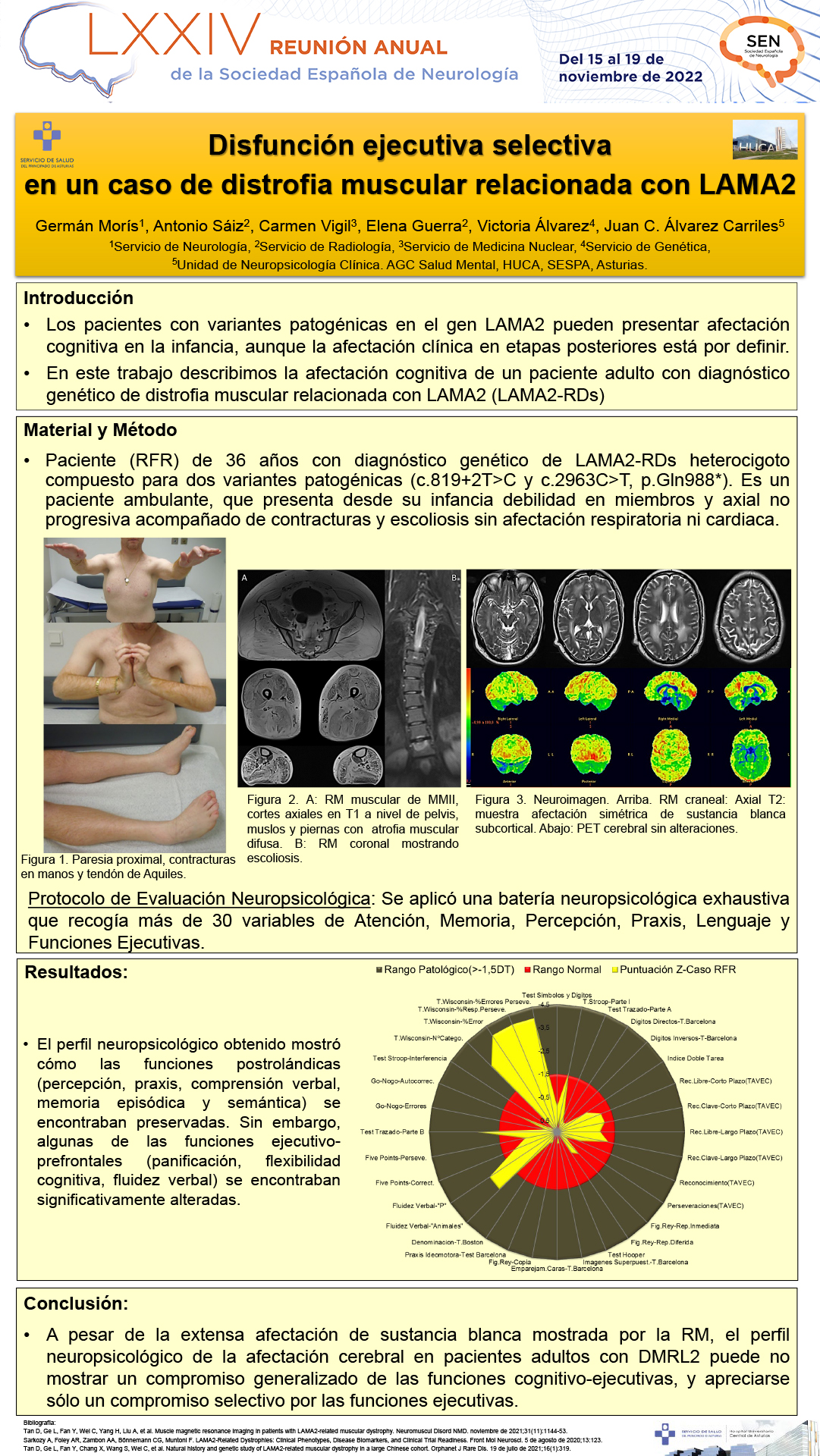Disfunción ejecutiva selectiva en un caso de distrofia muscular relacionada con LAMA2