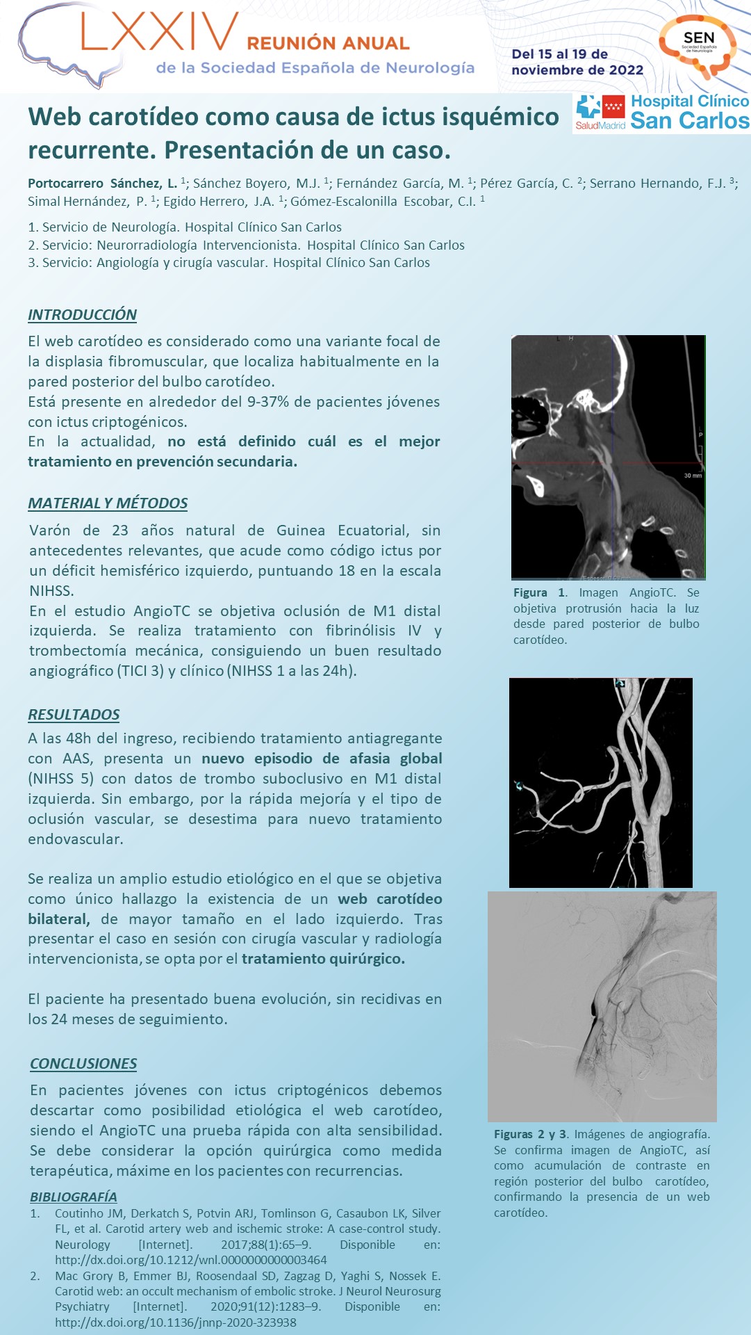 Web carotídeo como causa de ictus isquémico recurrente. Presentación de un caso