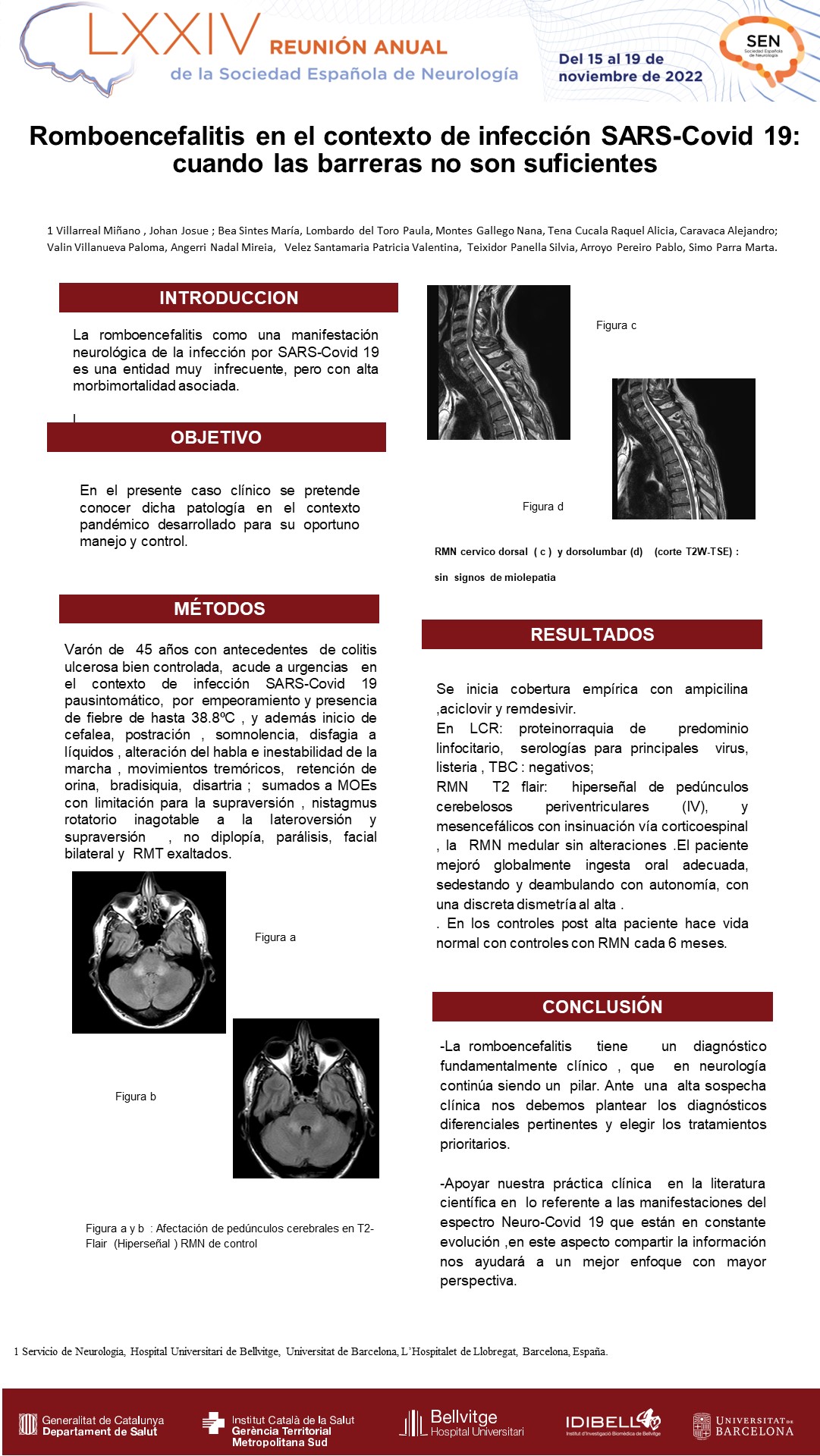 Romboencefalitis en el contexto de infección SARS-Covid 19: cuando las barreras no son suficientes