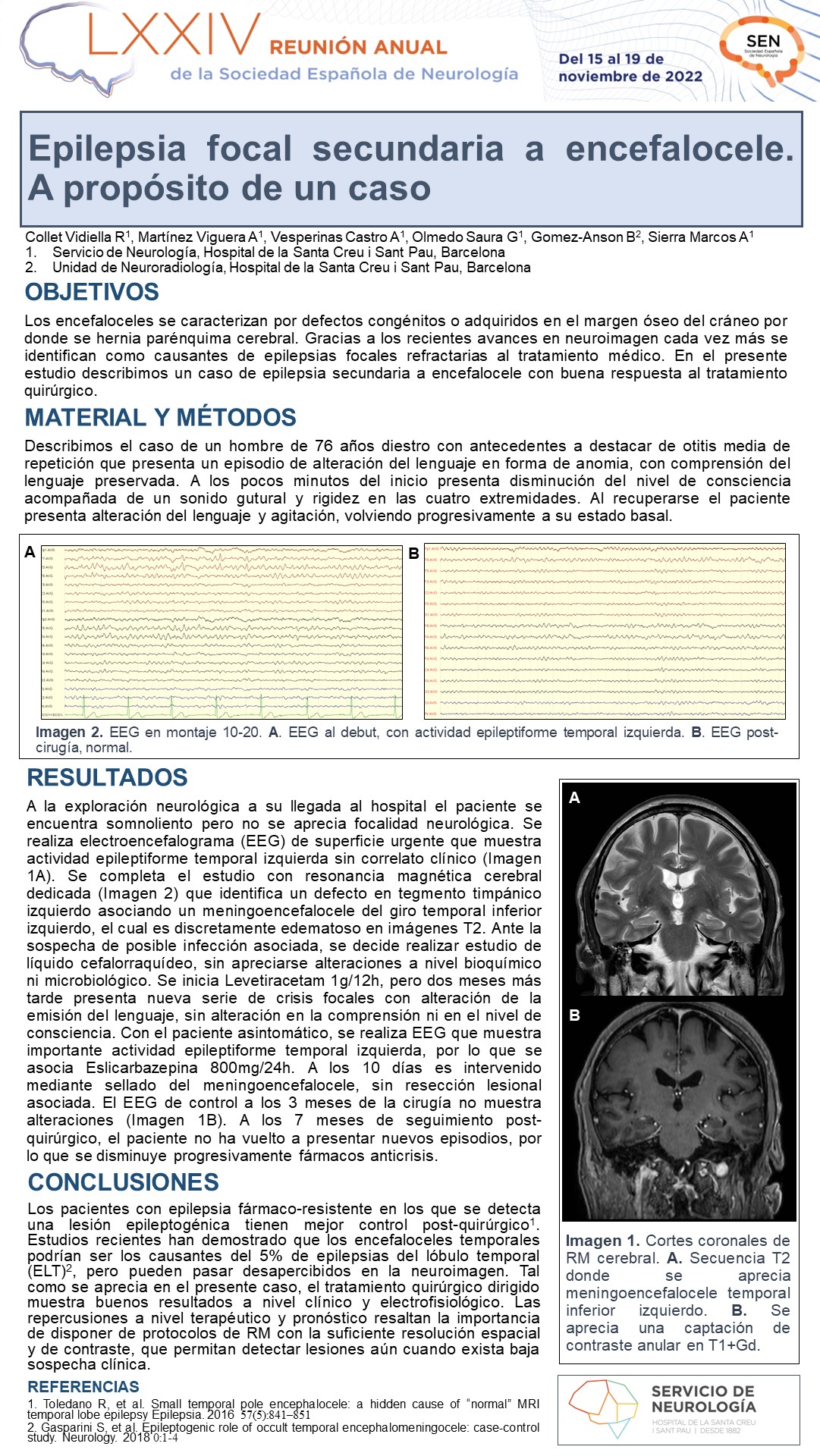 Epilepsia focal secundaria a encefalocele. A propósito de un caso