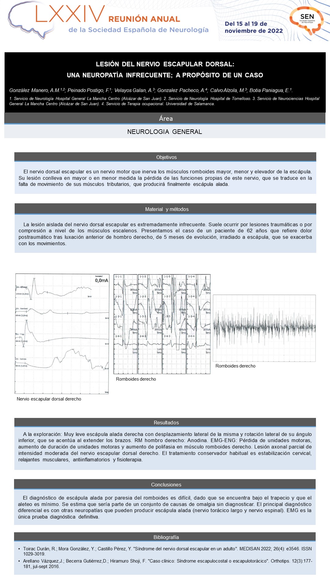 Lesión del nervio escapular dorsal: Una neuropatía infrecuente; a propósito de un caso