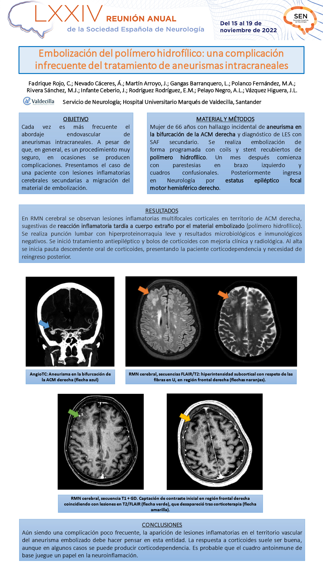 Embolización del polímero hidrofílico: una complicación infrecuente del tratamiento de aneurismas intracraneales