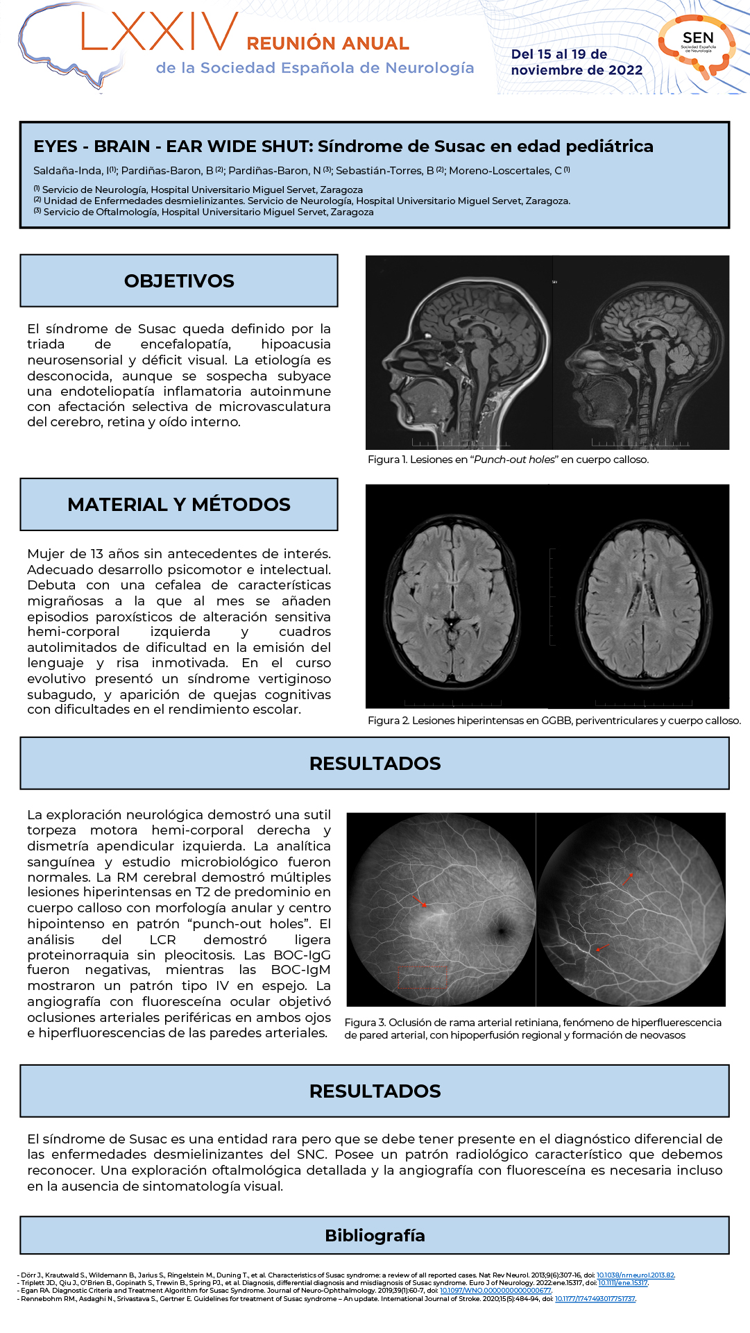 EYES – BRAIN – EAR WIDE SHUT: Síndrome de Susac en edad pediátrica