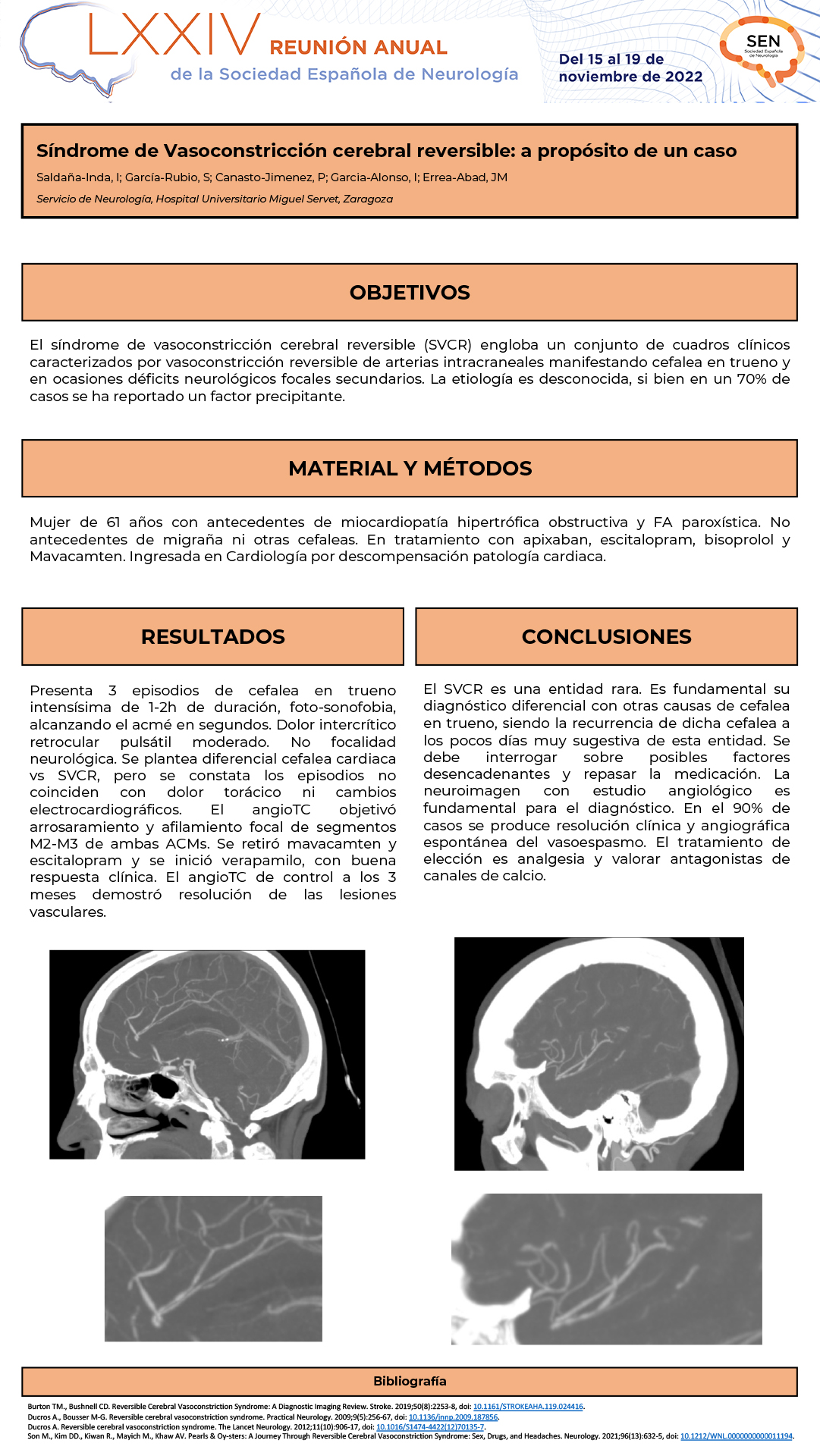 Síndrome de Vasoconstricción cerebral reversible: a propósito de un caso