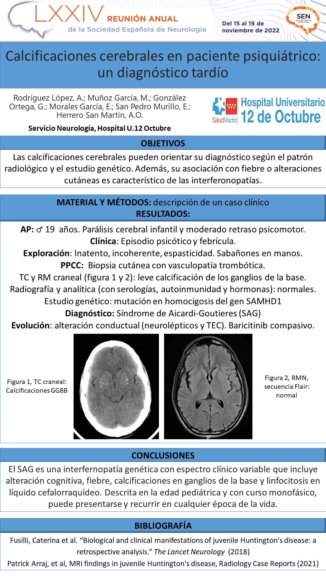 Calcificaciones cerebrales en paciente psiquiátrico: un diagnóstico tardío
