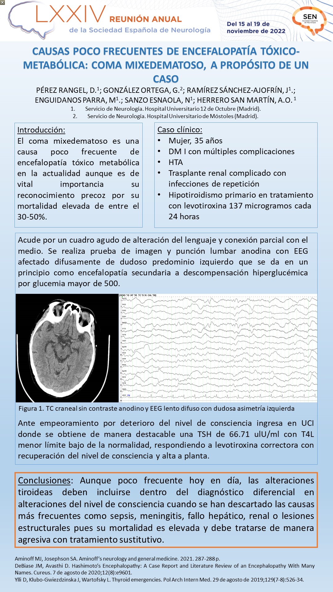 Causas poco frecuentes de encefalopatía tóxico-metabólica: coma mixedematoso, a propósito de un caso
