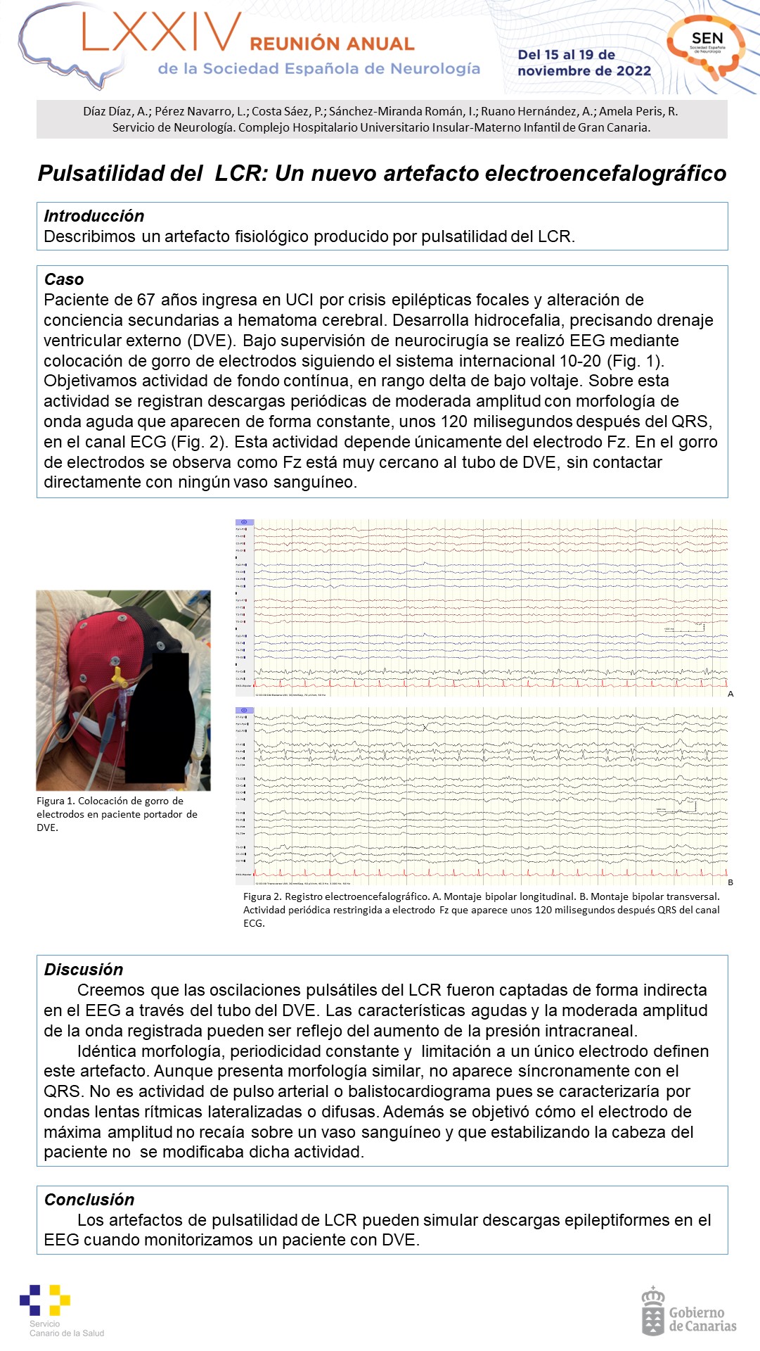Pulsatilidad del  LCR: Un nuevo artefacto electroencefalográfico