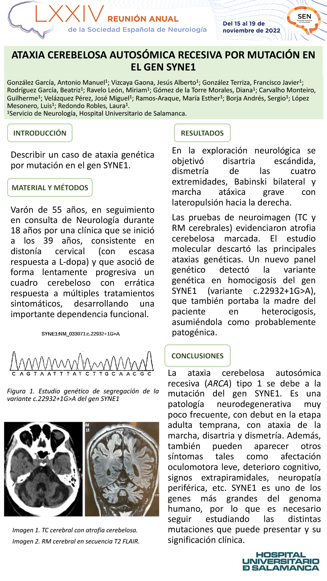 Ataxia cerebelosa autosómica recesiva por mutación en el gen SYNE1