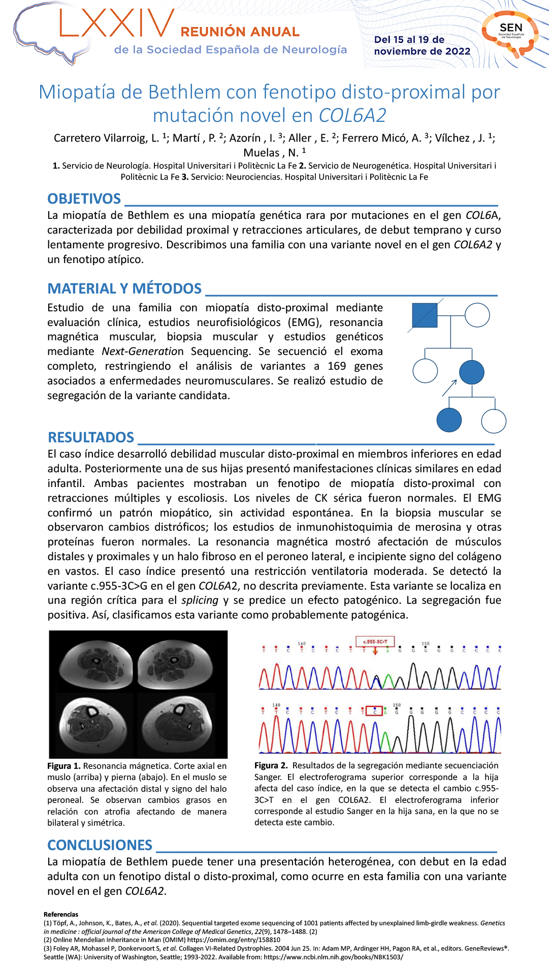 Miopatía de Bethlem con fenotipo disto-proximal por mutación novel en COL6A2
