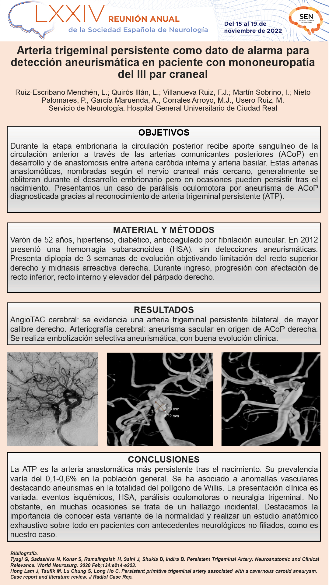 Arteria trigeminal persistente como dato de alarma para detección aneurismática en paciente con mononeuropatía del III par craneal