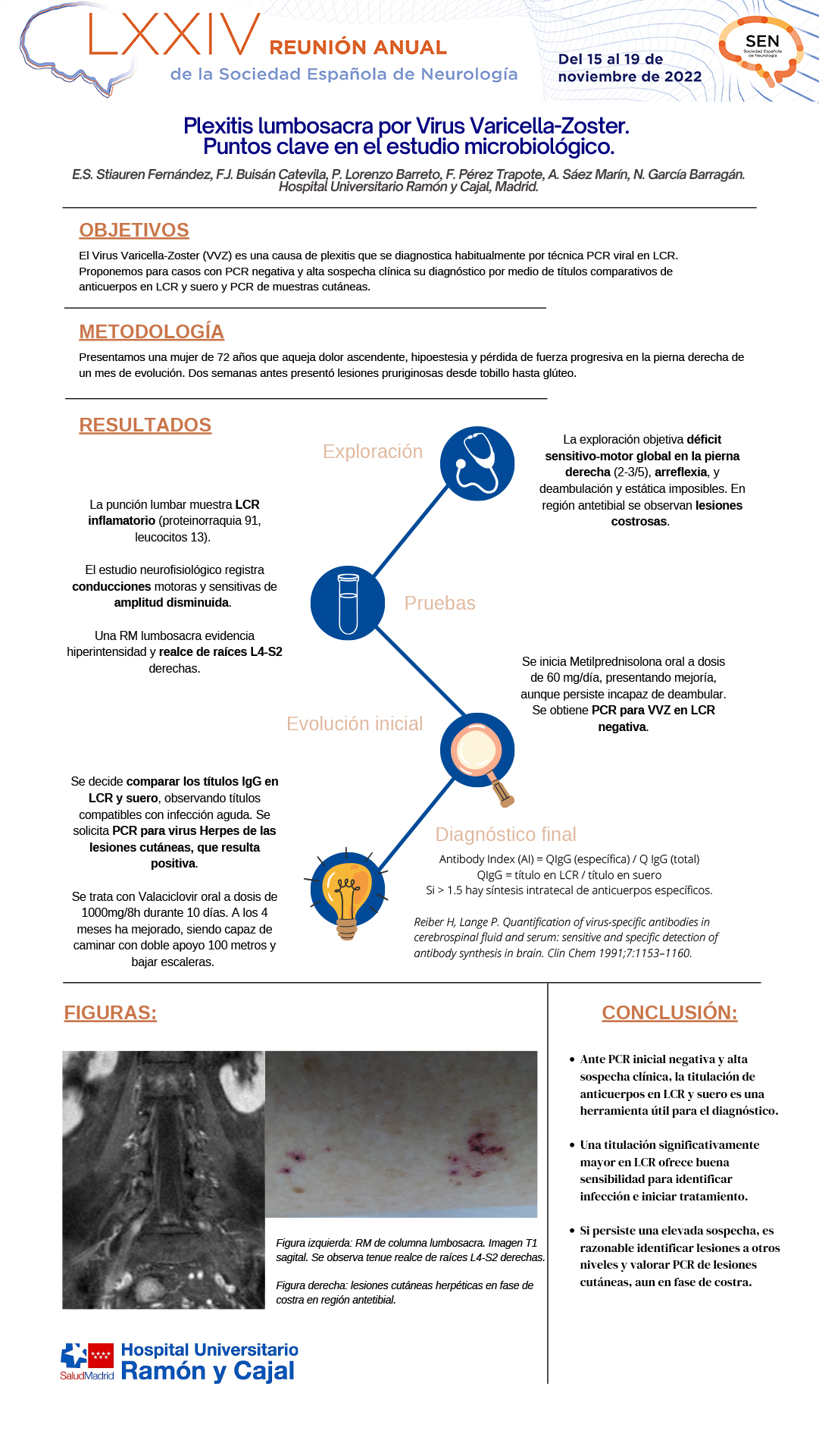 Plexitis lumbosacra por Virus Varicella-Zoster. Puntos clave en el estudio microbiológico