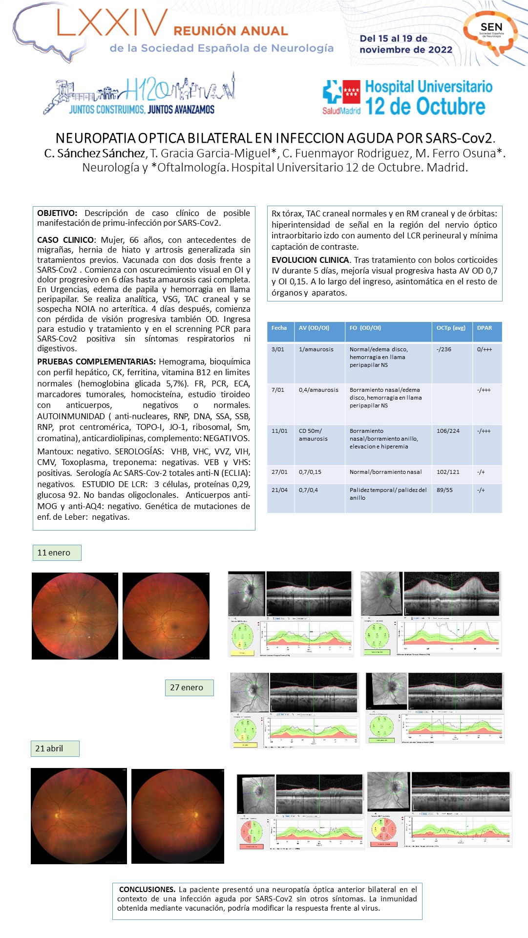 Neuropatía óptica bilateral en infección aguda por SARS-Cov2