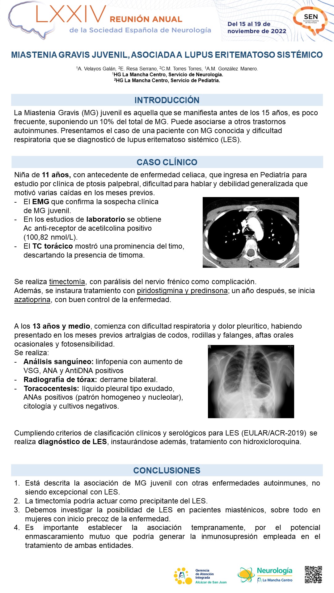 Miastenia gravis juvenil, asociada a lupus eritematoso sistémico