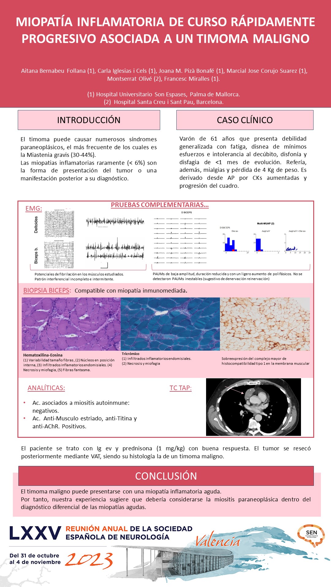 Miopatía inflamatoria de curso rápidamente progresivo asociada a un timoma maligno