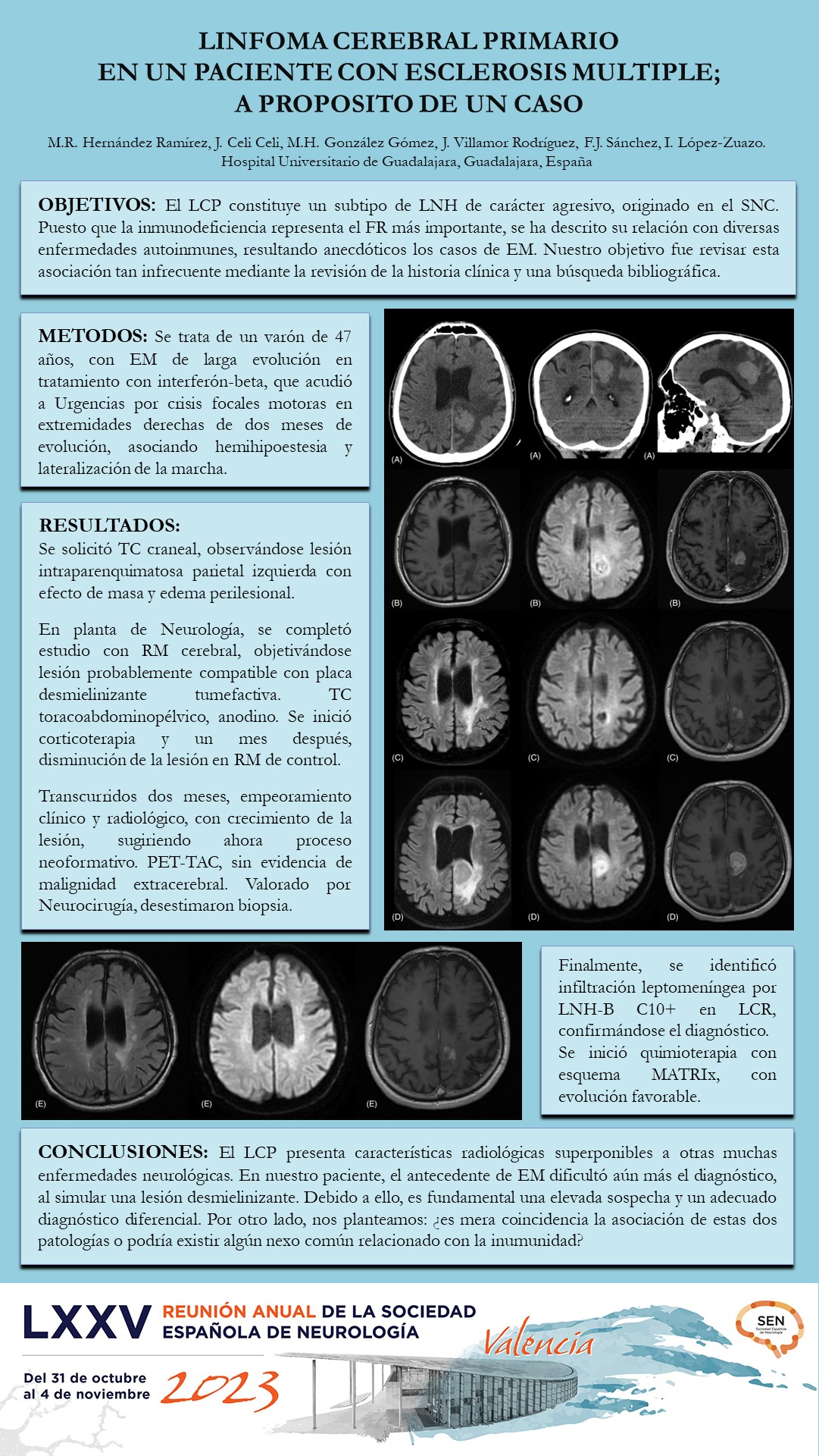Linfoma cerebral primario en un paciente con esclerosis múltiple; a propósito de un caso 