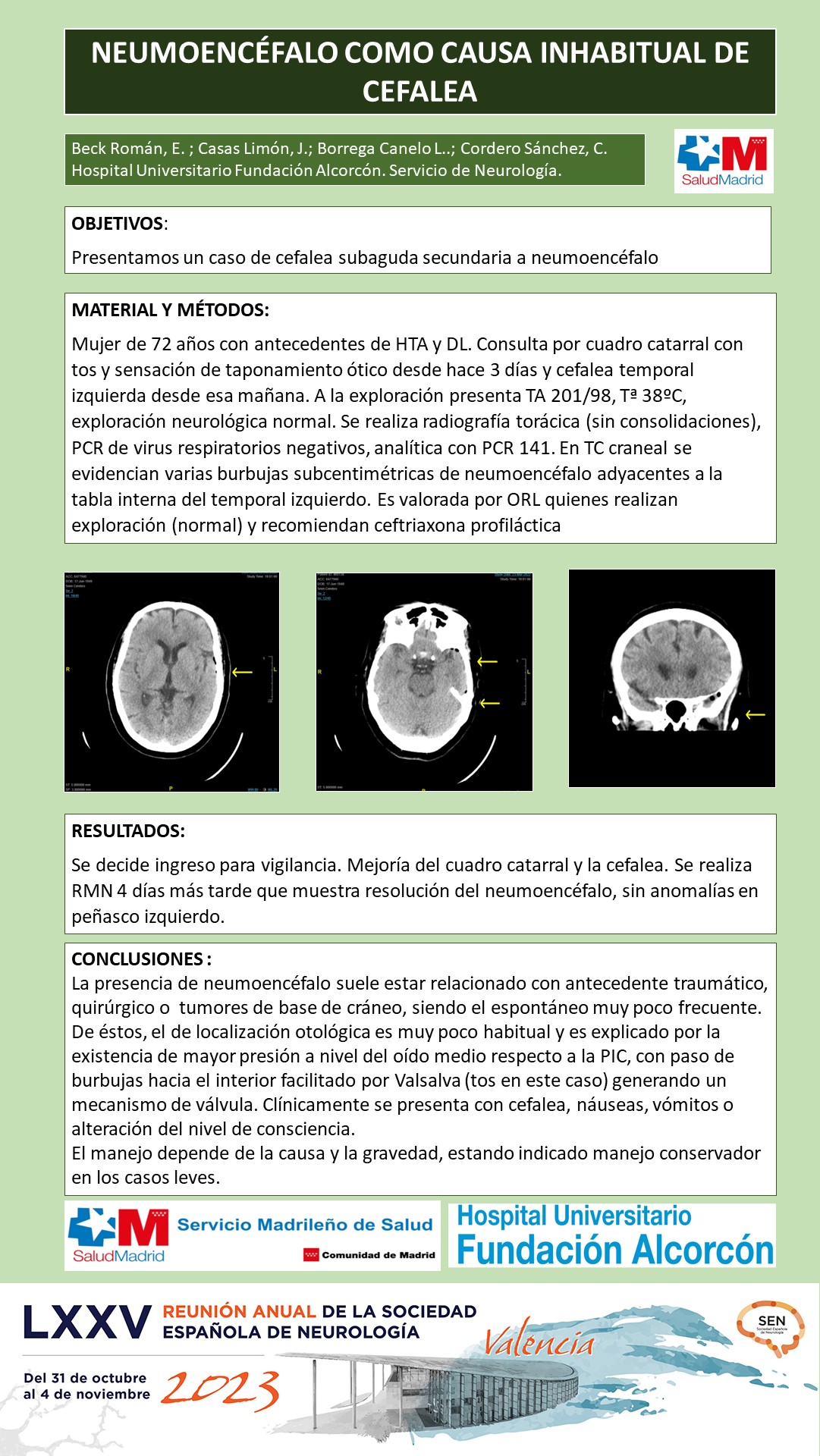 Neumoencéfalo como causa inhabitual de cefalea secundaria