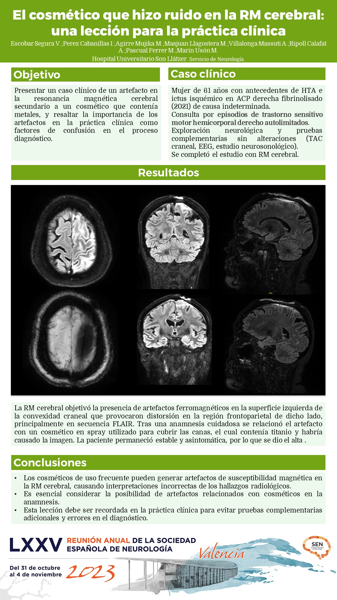 El cosmético que hizo ruido en la RM cerebral: una lección para la práctica clínica