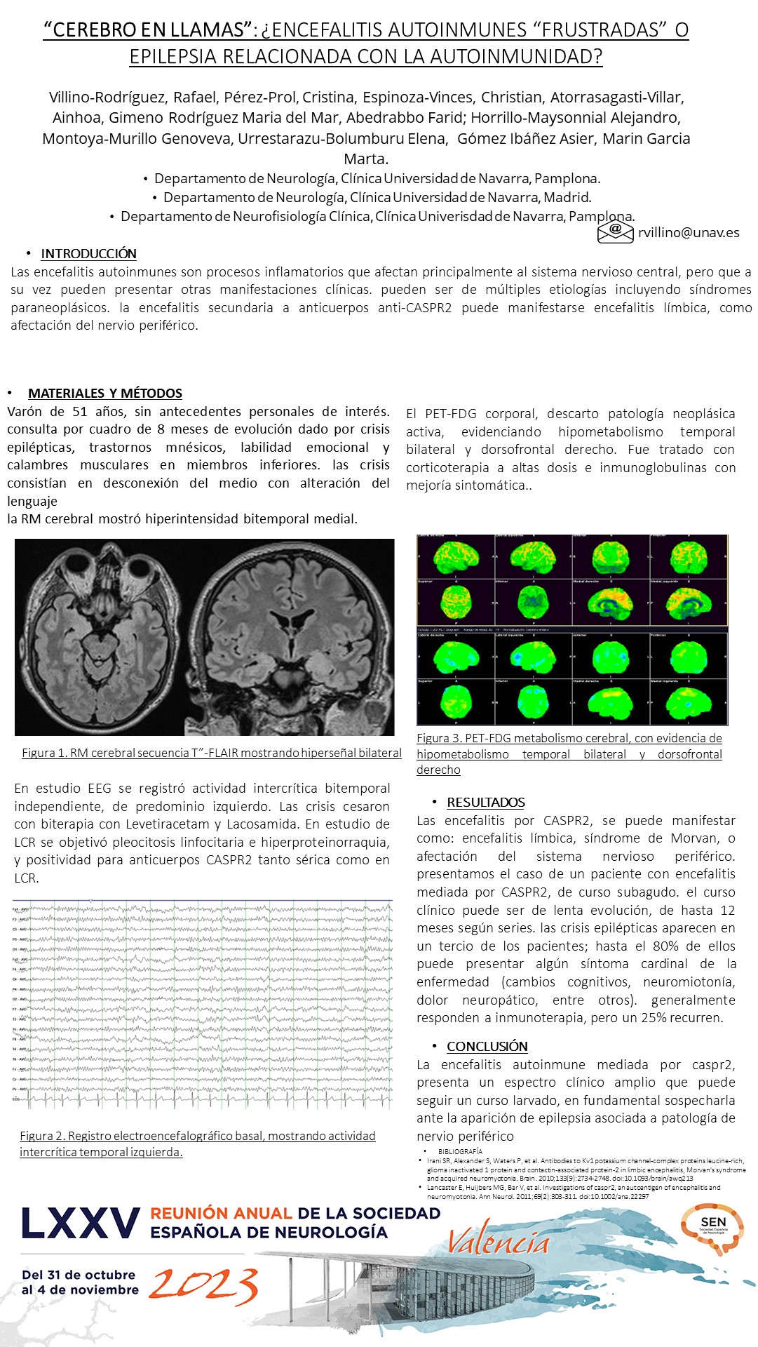 “Cerebro en llamas”: ¿Encefalitis autoinmunes “frustradas” o epilepsia relacionada con la autoinmunidad?