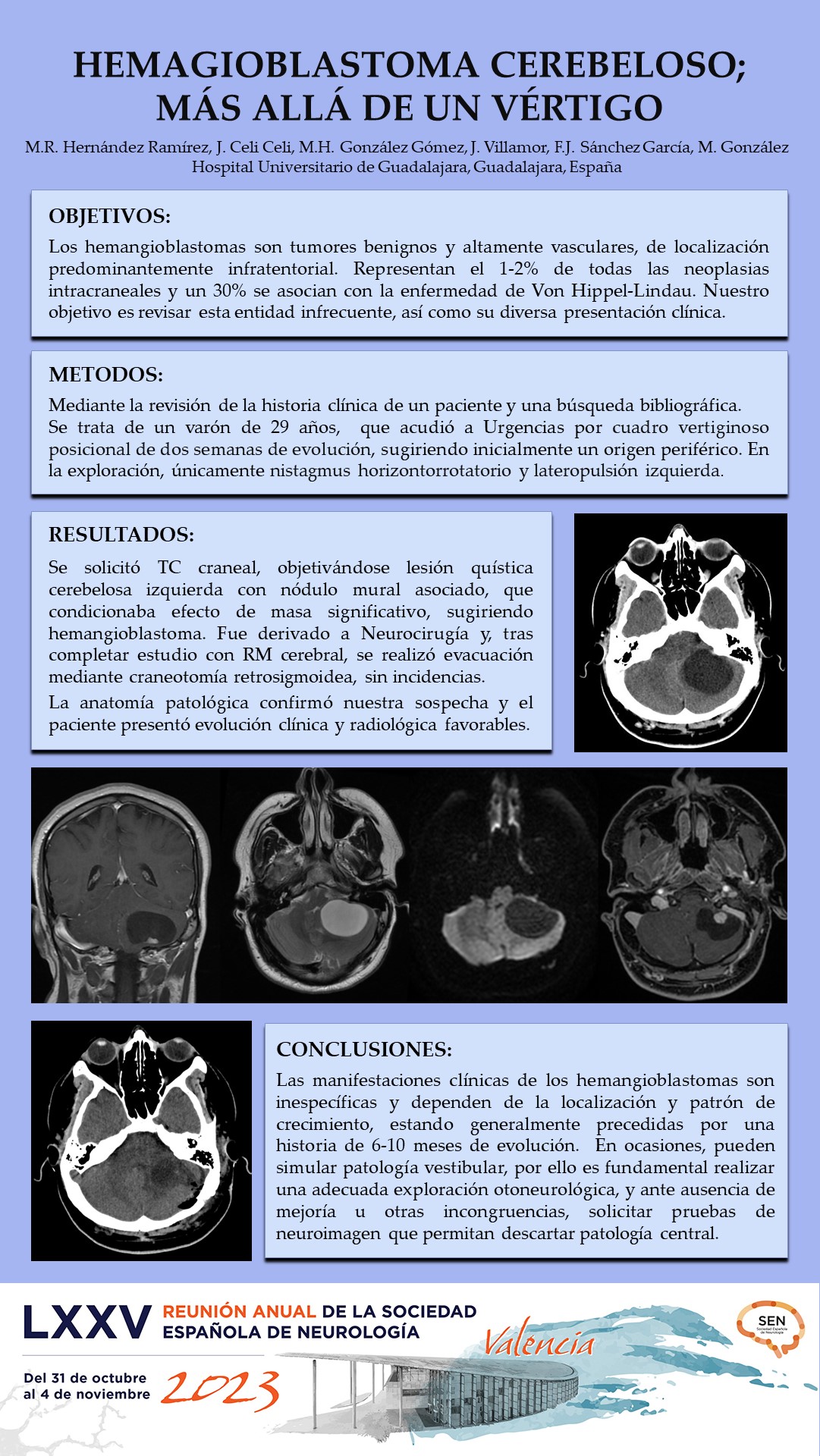 Hemangioblastoma cerebeloso; más allá de un vértigo
