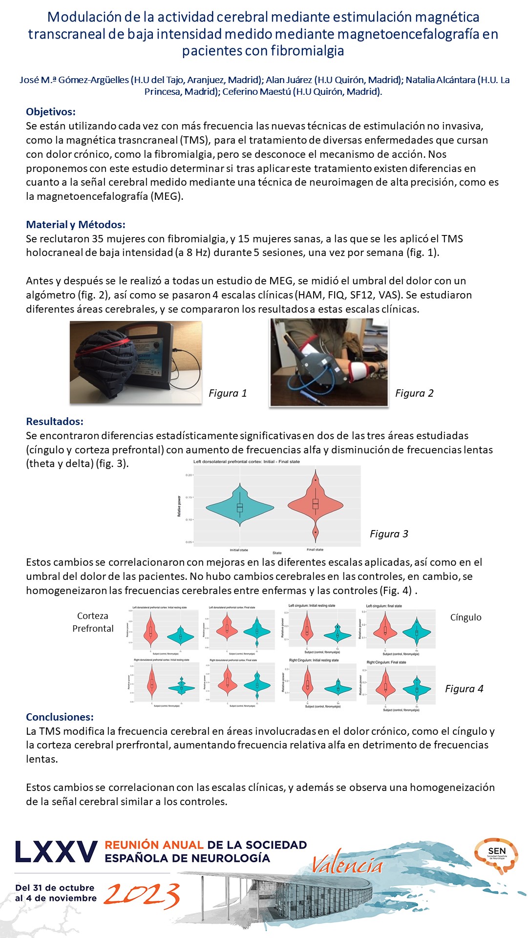 Modulación de la actividad cerebral mediante estimulación magnética transcraneal de baja intensidad medido mediante magnetoencefalografía en pacientes con fibromialgia
