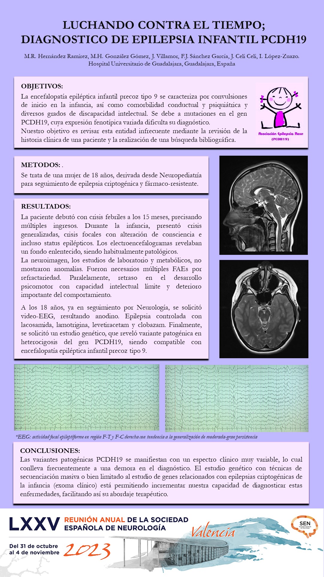 Luchando contra el tiempo; diagnóstico de Epilepsia Infantil PCDH19