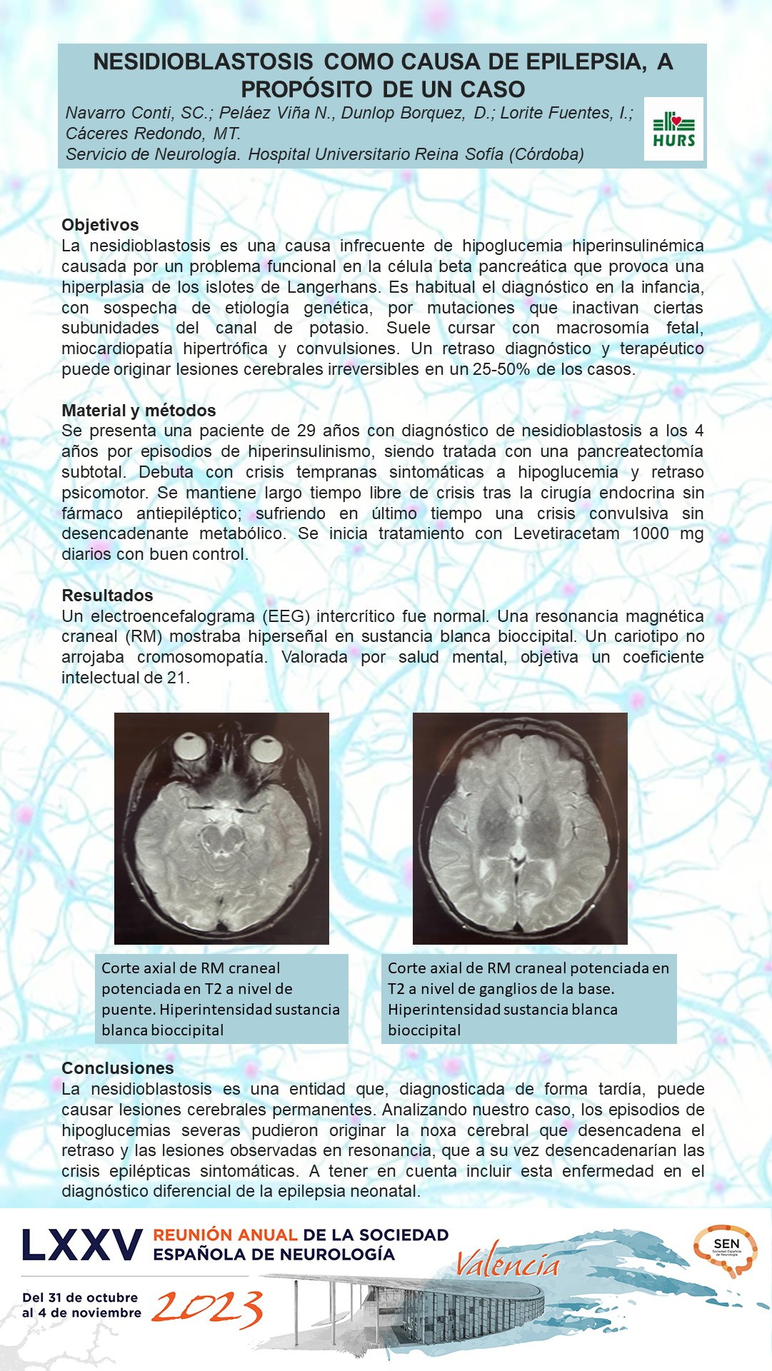 Nesidioblastosis como causa de epilepsia, a propósito de un caso 