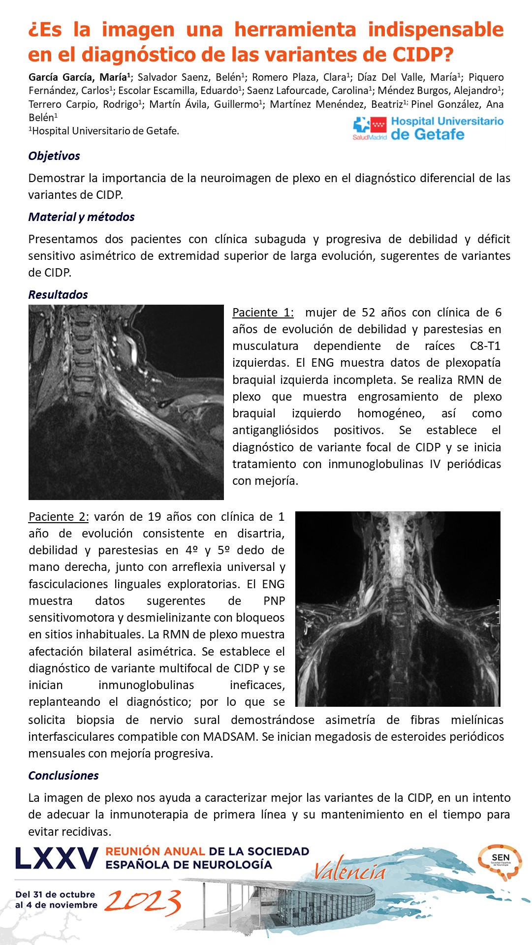 ¿Es la imagen una herramienta indispensable en el diagnóstico de las variantes de CIDP?