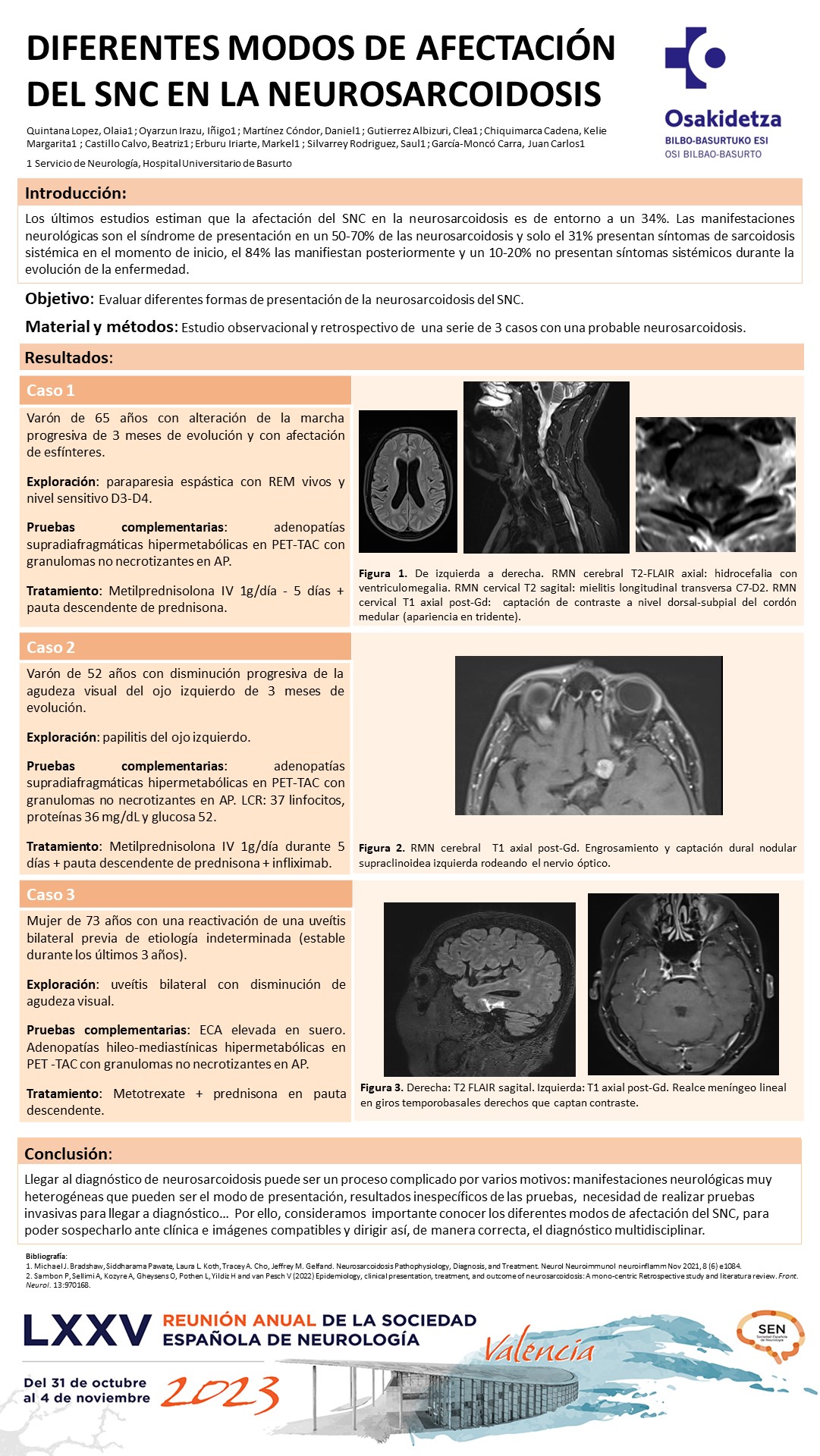 Diferentes modos de afectación del sistema nervioso central en la neurosarcoidosis