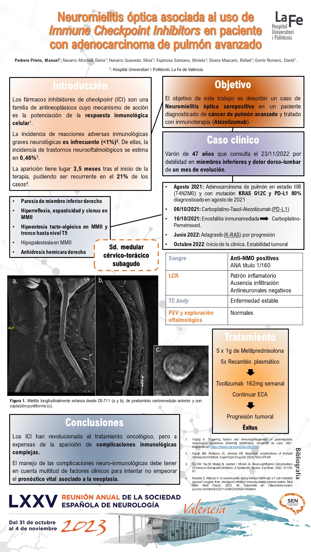 Neuromielitis óptica asociada al uso de Immune Checkpoint Inhibitors en paciente con Adenocarcinoma de pulmón avanzado
