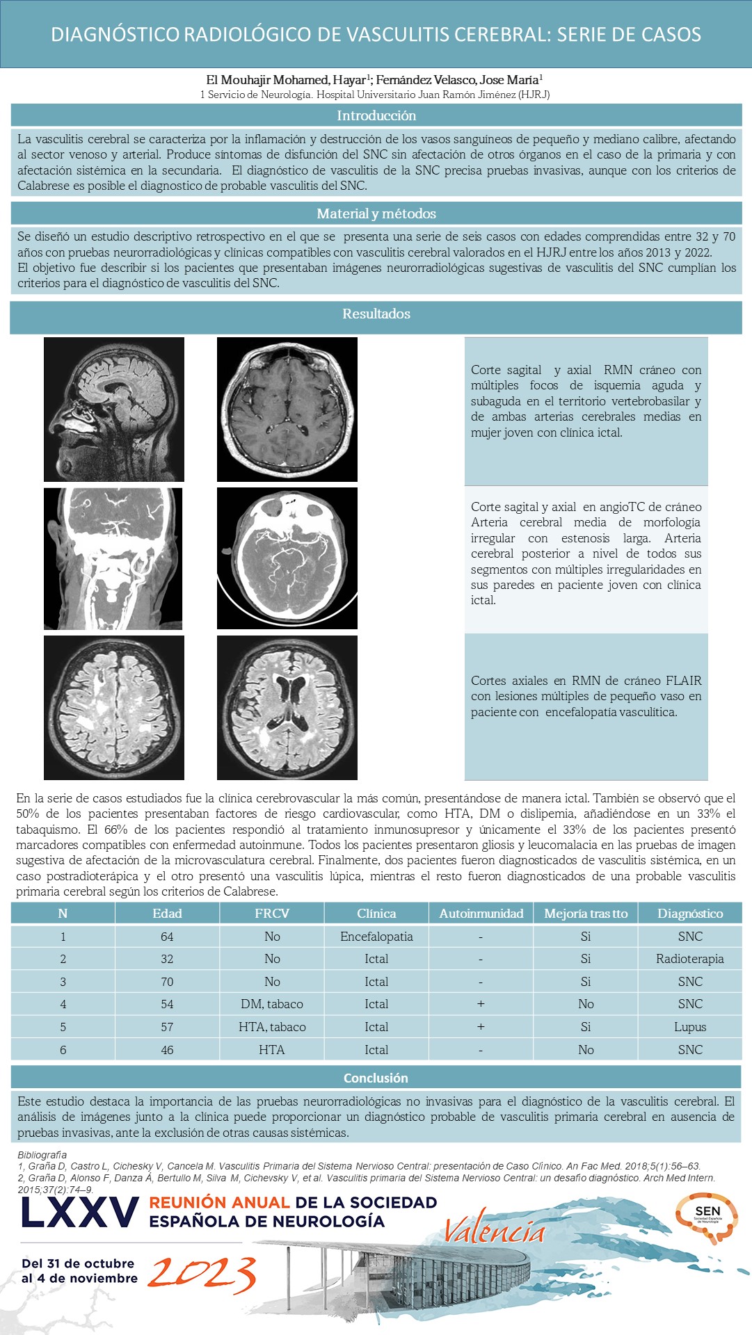 Diagnóstico radiológico de vasculitis cerebral: serie de casos