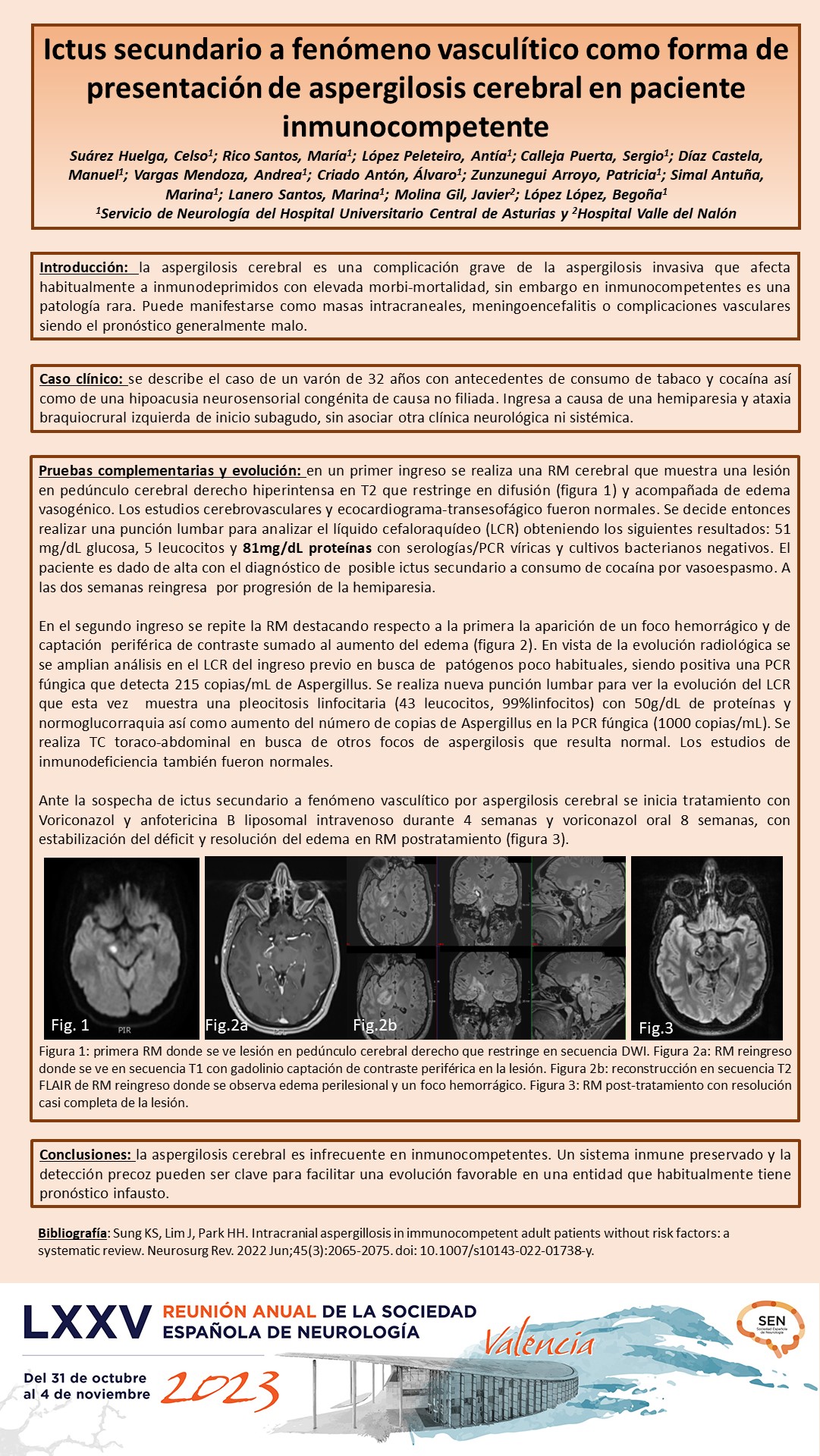 Ictus secundario a fenómeno vasculítico como forma de presentación de aspergilosis cerebral en paciente inmunocompetente