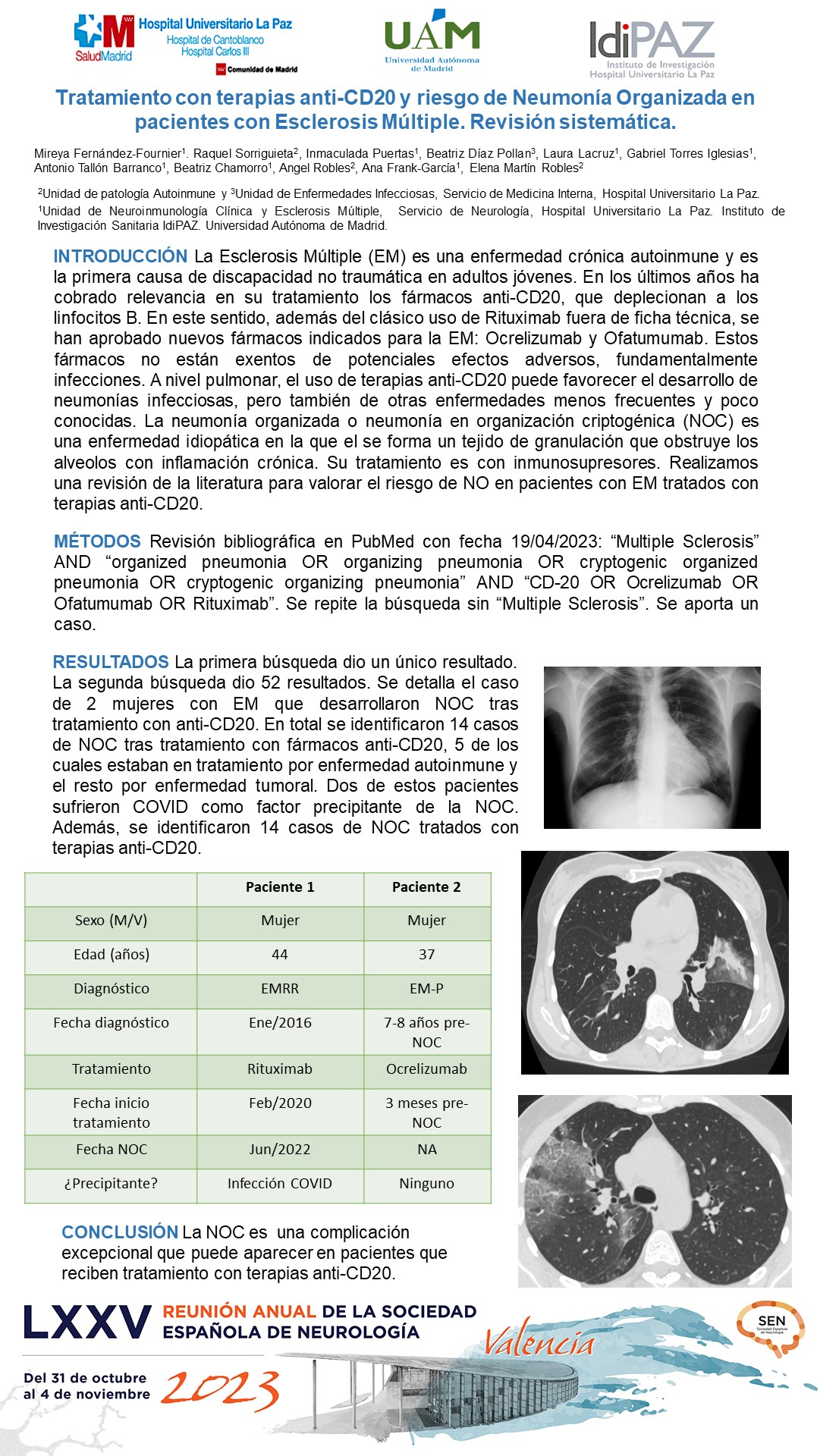 Tratamiento con terapias anti-CD20 y riesgo de neumonía en organización criptogénica en pacientes con Esclerosis Múltiple. Revisión sistematica