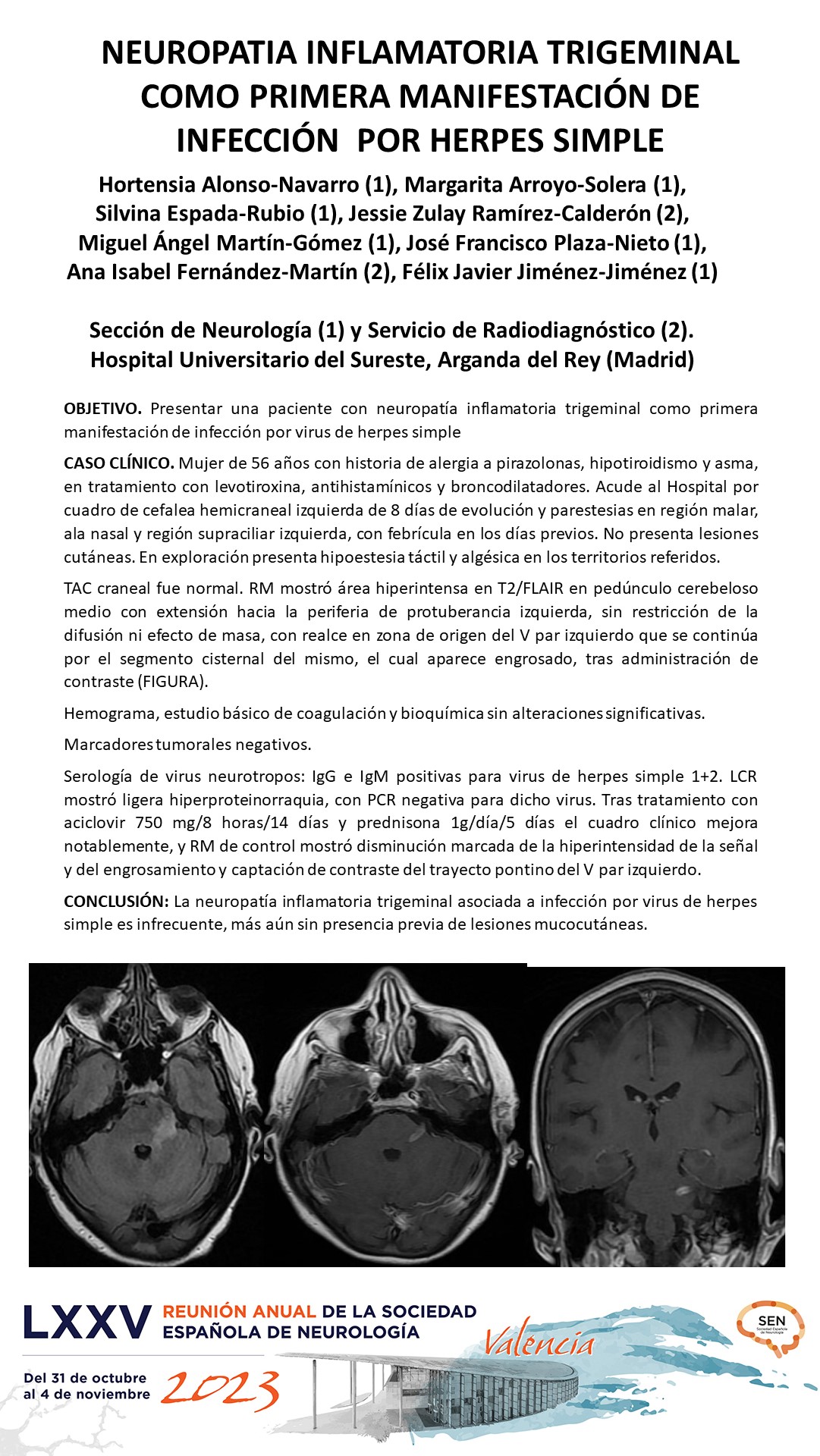 Neuropatía inflamatoria trigeminal como primera manifestación de infección por virus de herpes simple