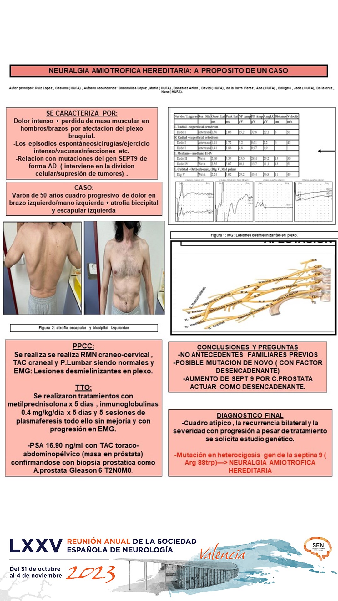 Neuralgia amiotrófica hereditaria y su relación con el cáncer y vía séptinas; a propósito de un caso