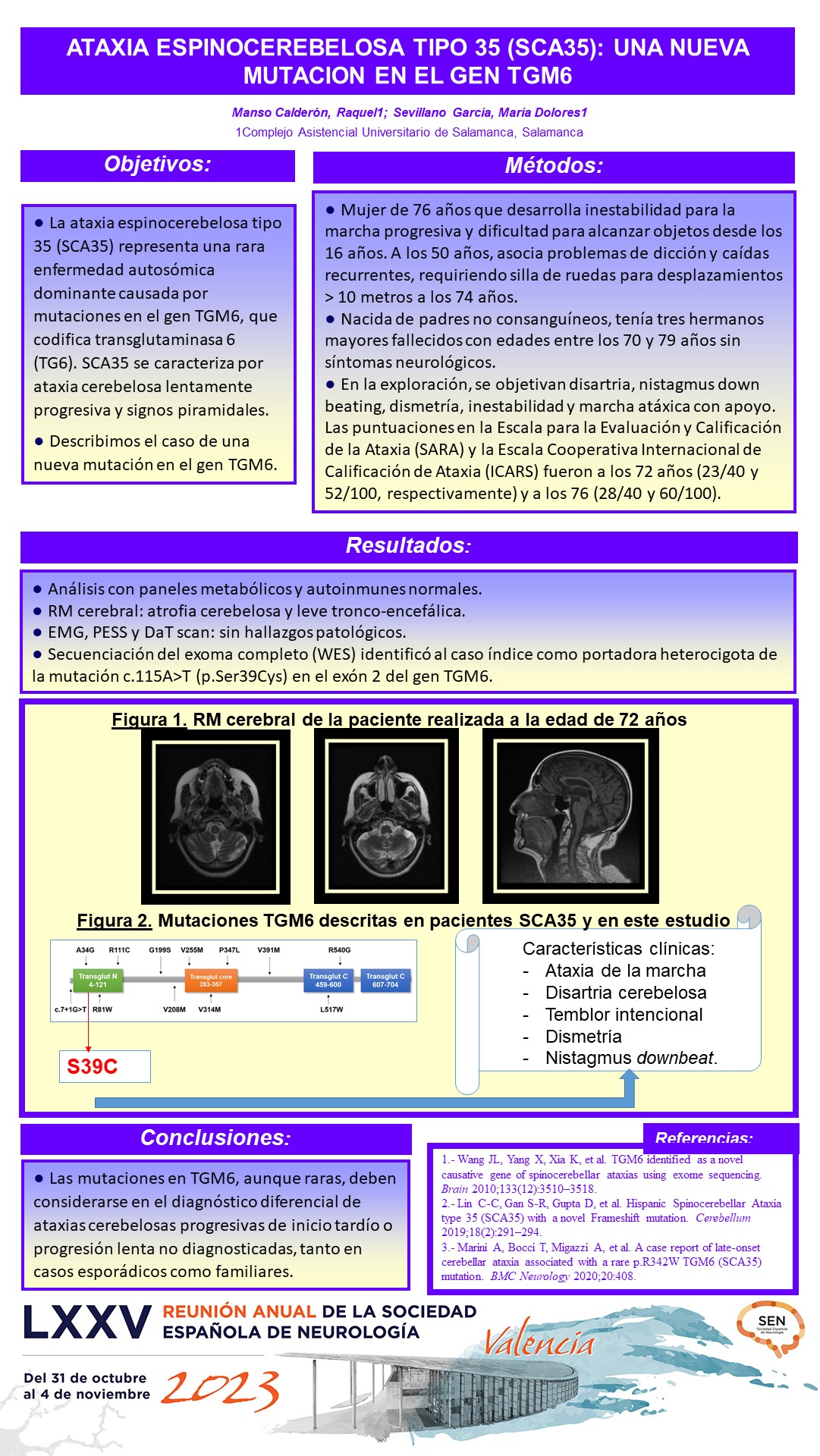 Ataxia espinocerebelosa tipo 35 (SCA35): una nueva mutación en el gen TGM6