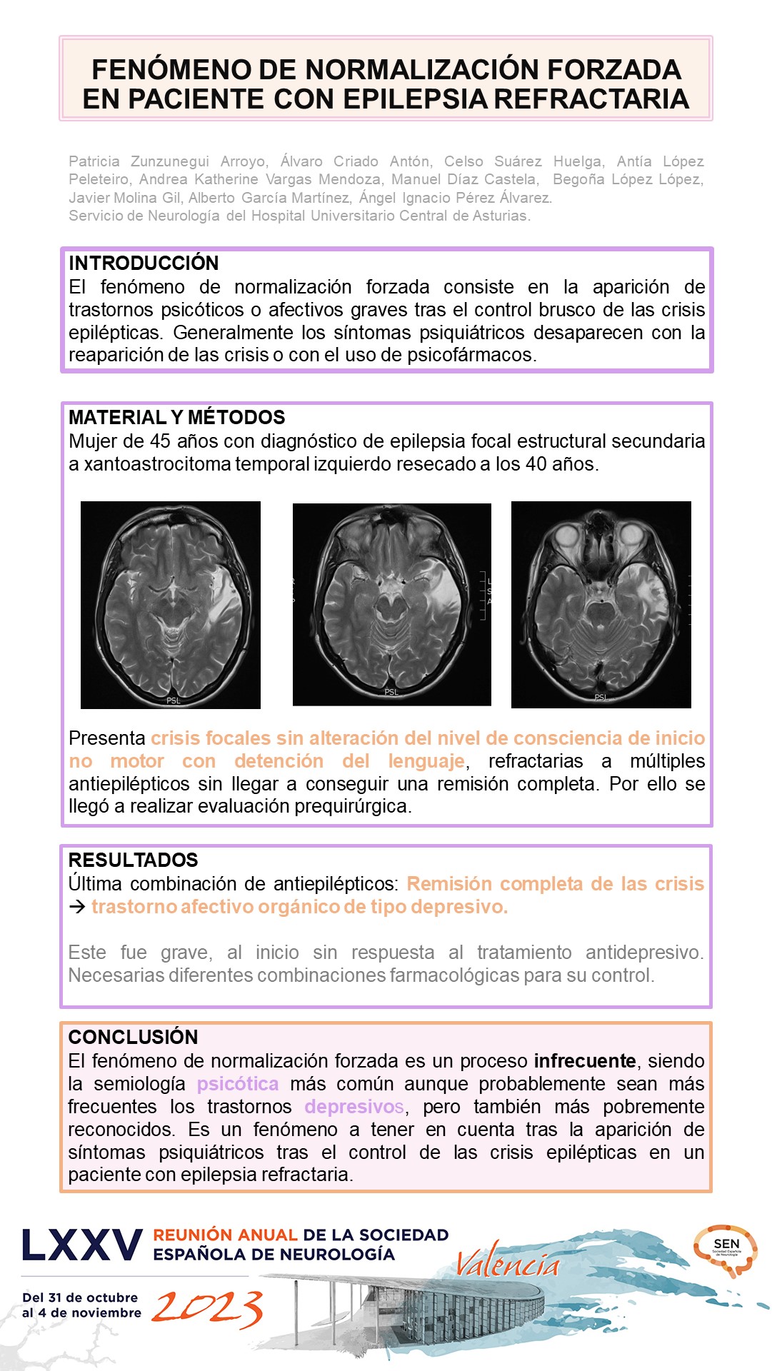Fenómeno de normalización forzada en paciente con epilepsia refractaria