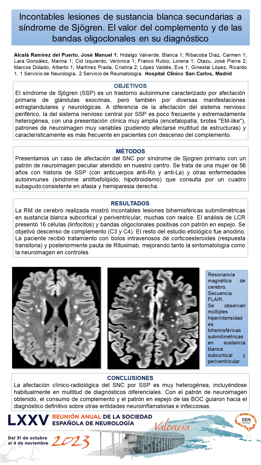 Incontables lesiones de sustancia blanca secundarias a síndrome de Sjögren. El valor del complemento y de las bandas oligoclonales en su diagnóstico