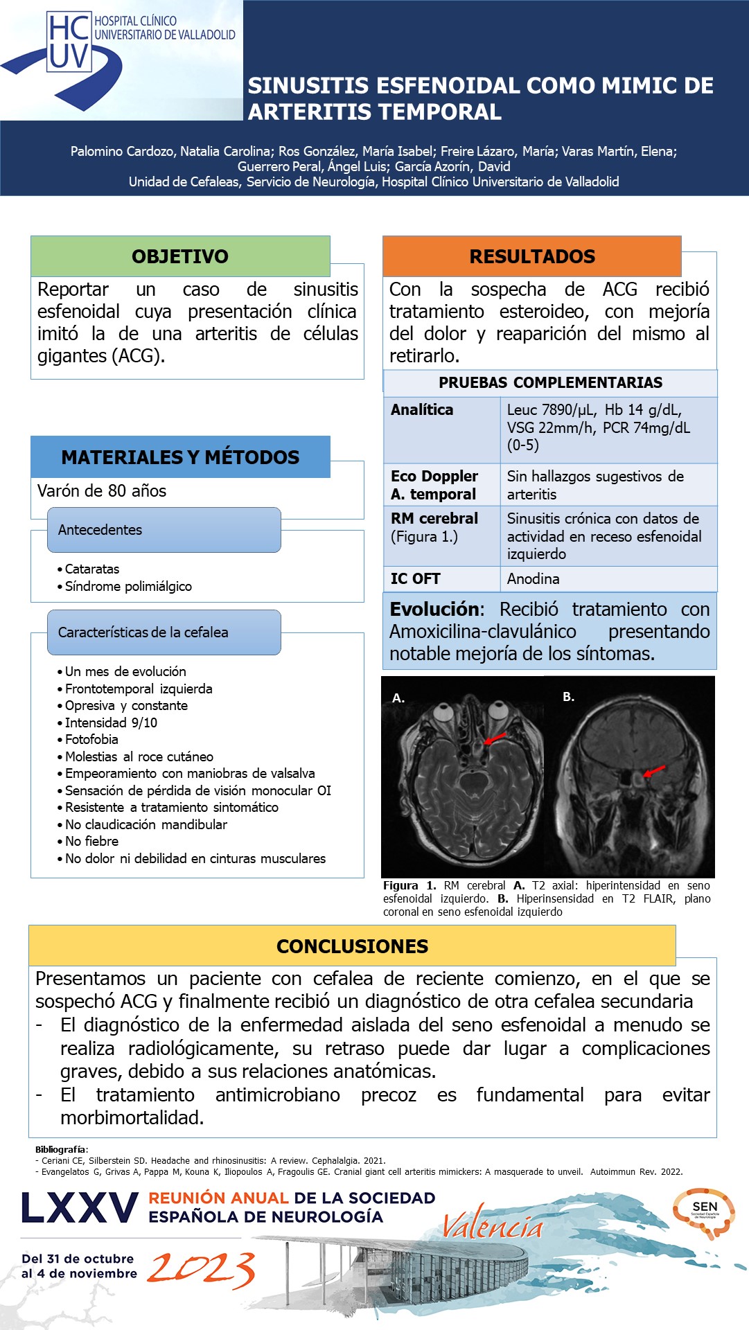 Sinusitis esfenoidal como mimic de arteritis temporal