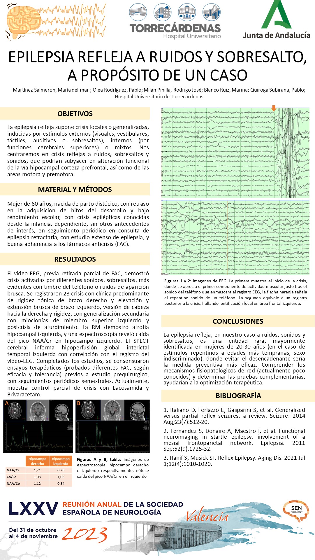 Epilepsia refleja a ruidos y sobresalto, a propósito de un caso