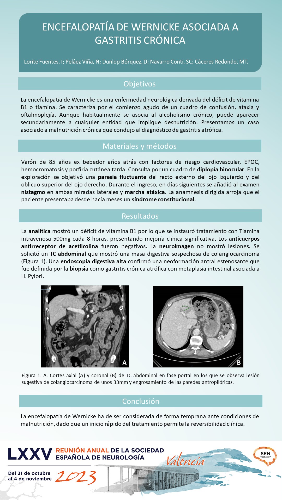 Encefalopatía de Wernicke asociada a gastritis crónica